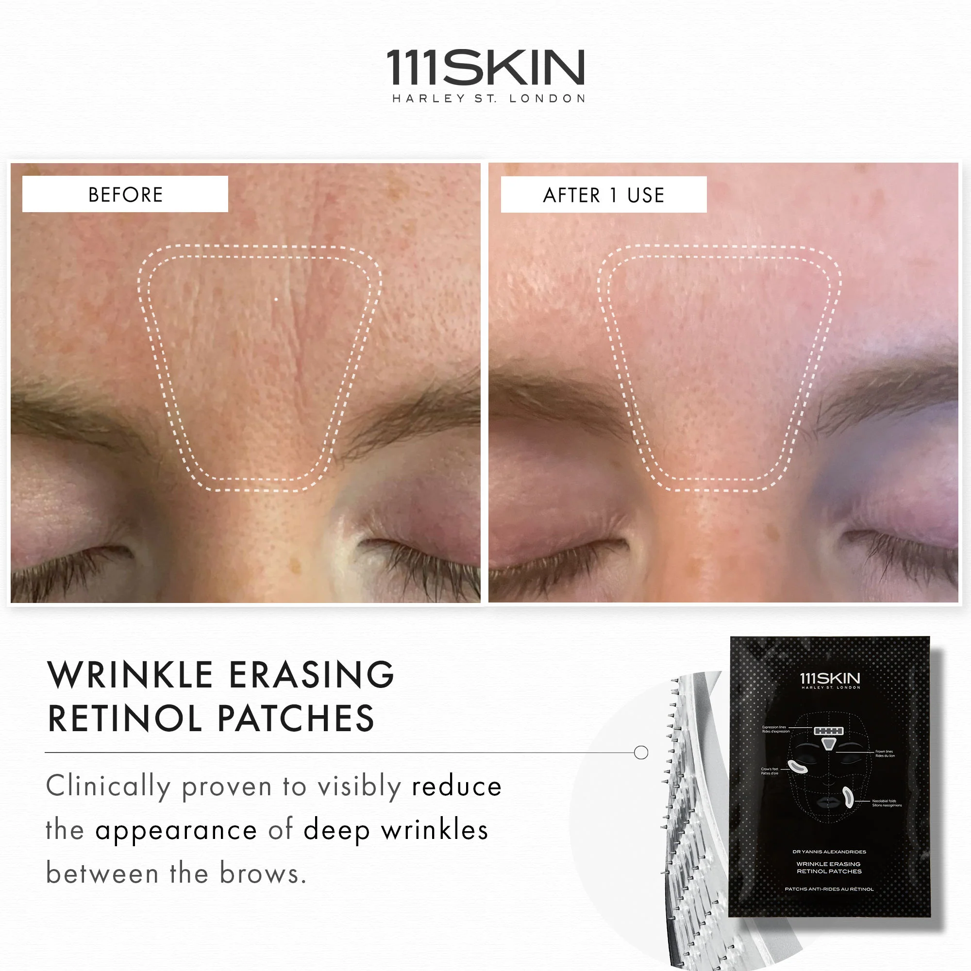 Wrinkle Erasing Retinol Patches - Image 3