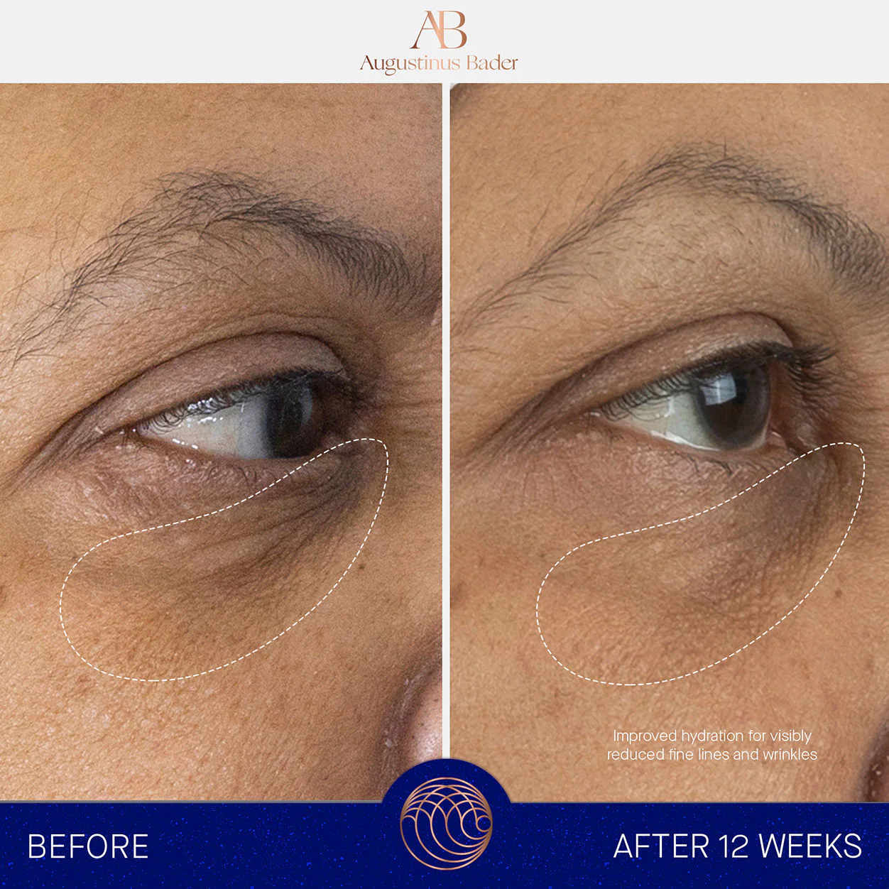 The Eye Cream Nomad - Image 5