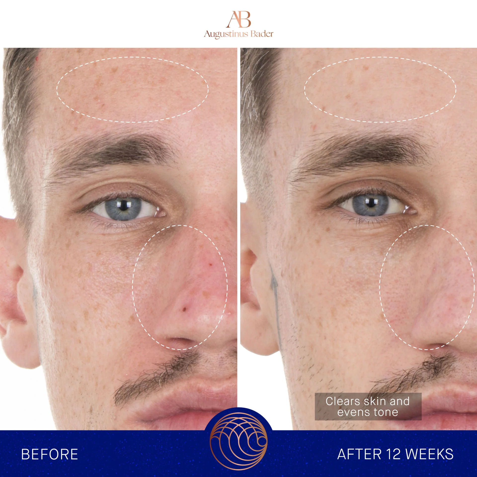 The Retinol Serum - Image 3
