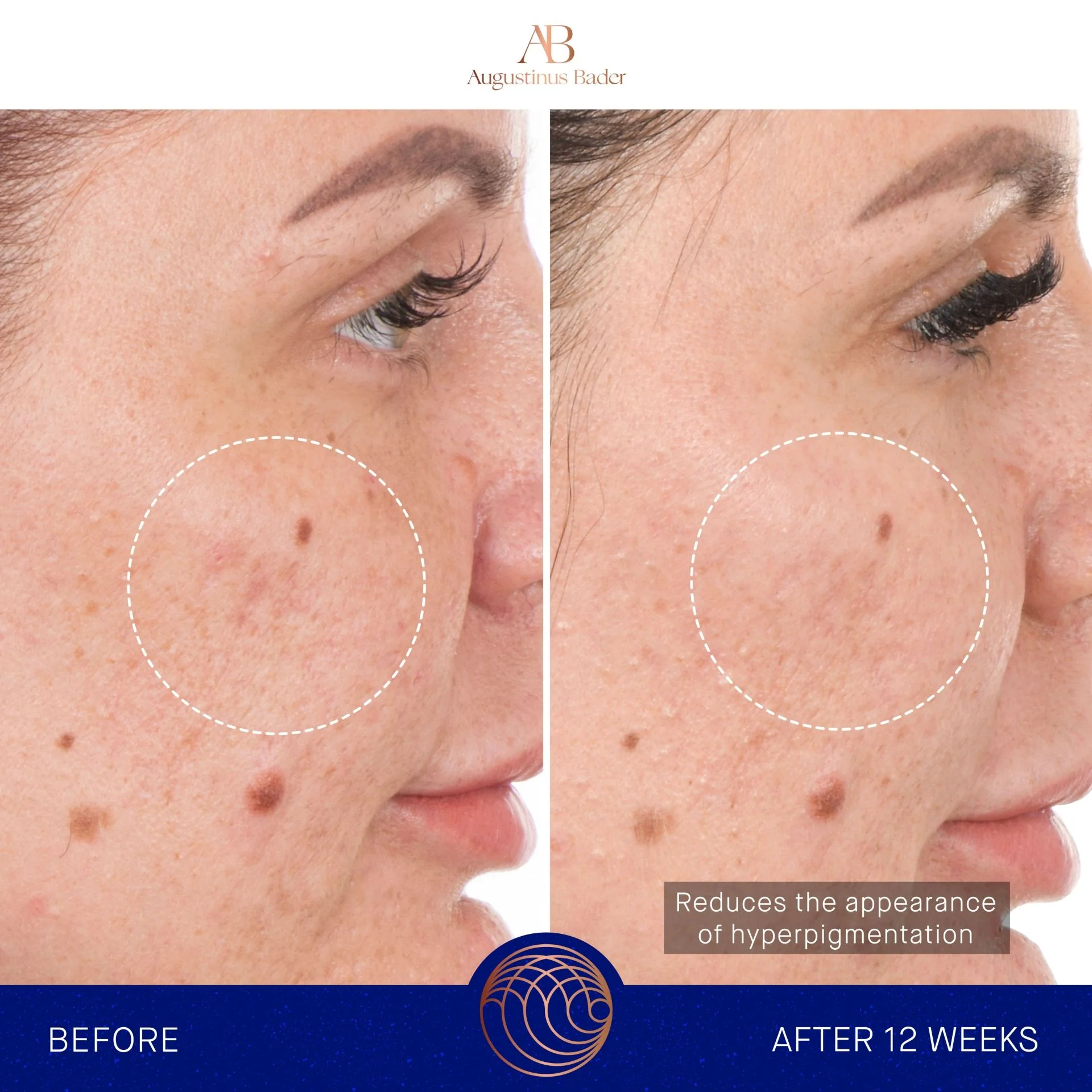 The Retinol Serum - Image 4