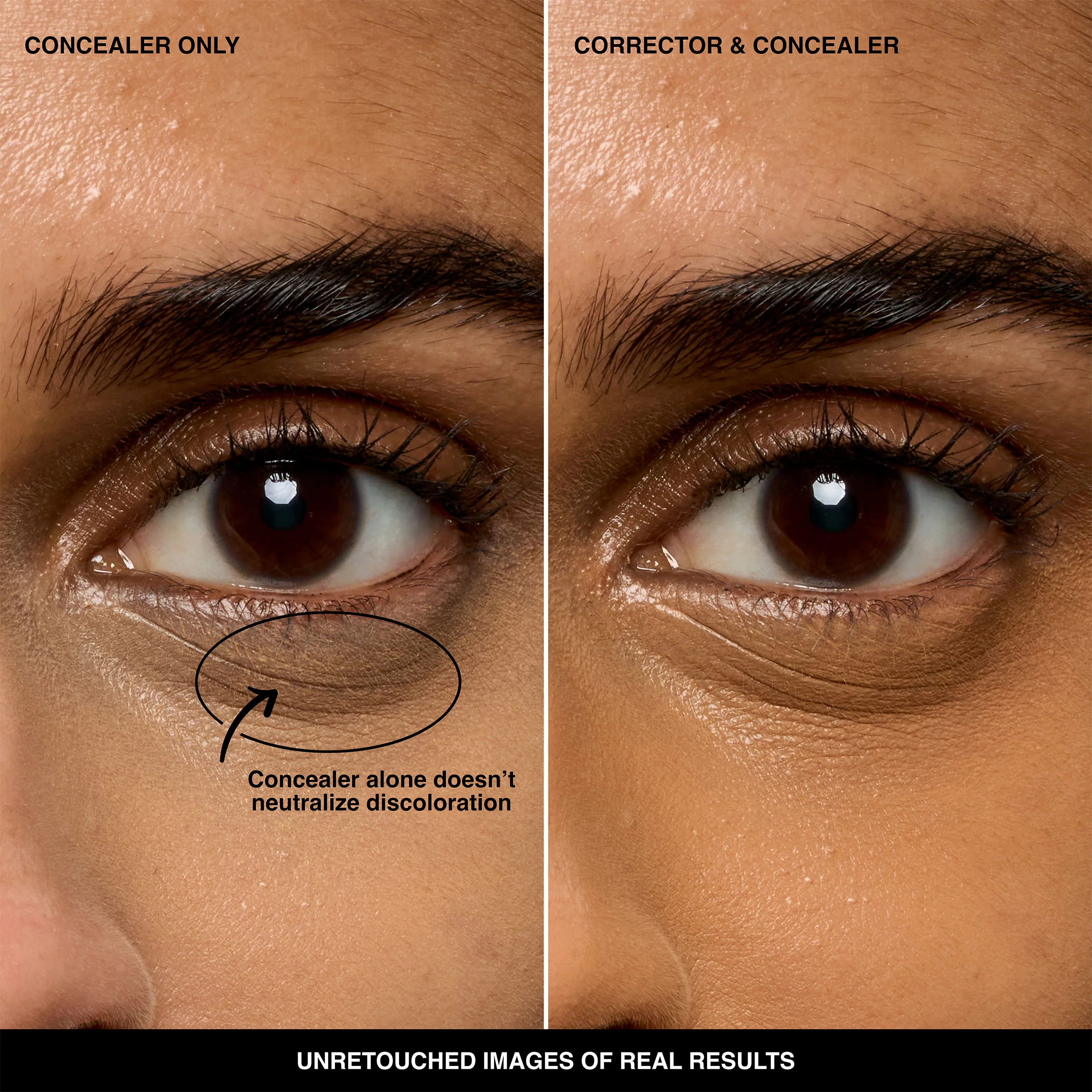 Skin Corrector Stick - Image 5