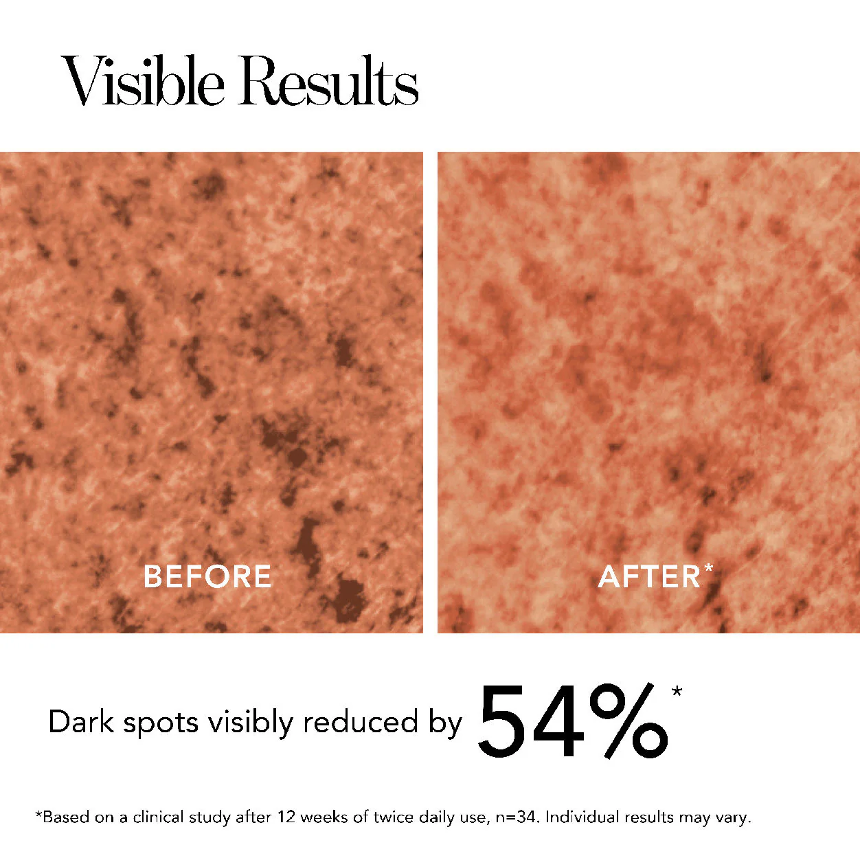 Blanc Peony Eye Serum Dark Spot Corrector - Image 3