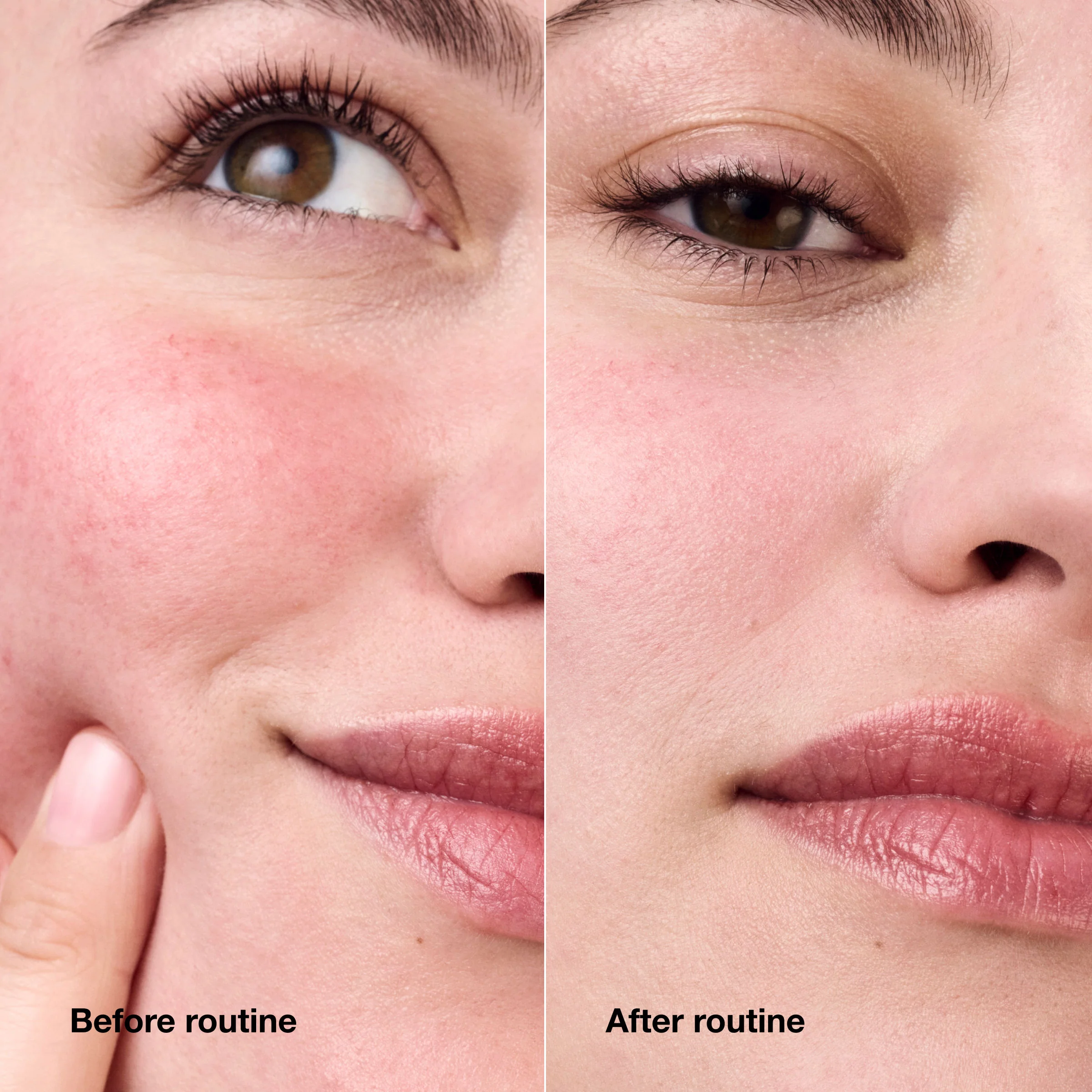 Redness Solutions Daily Relief Cream With Probiotic Technology - Image 3
