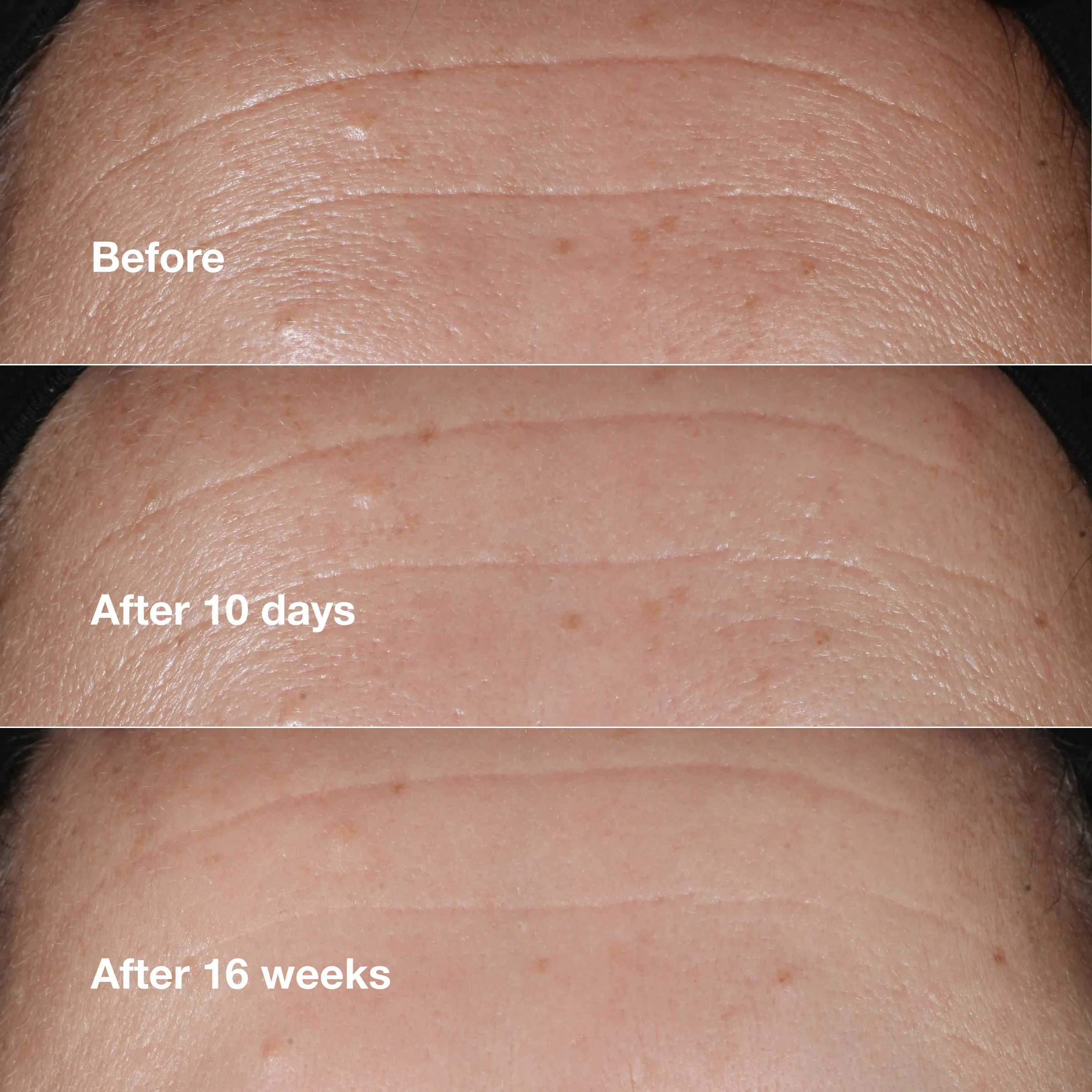 Smart Clinical Repair Wrinkle Correcting Serum - Image 3