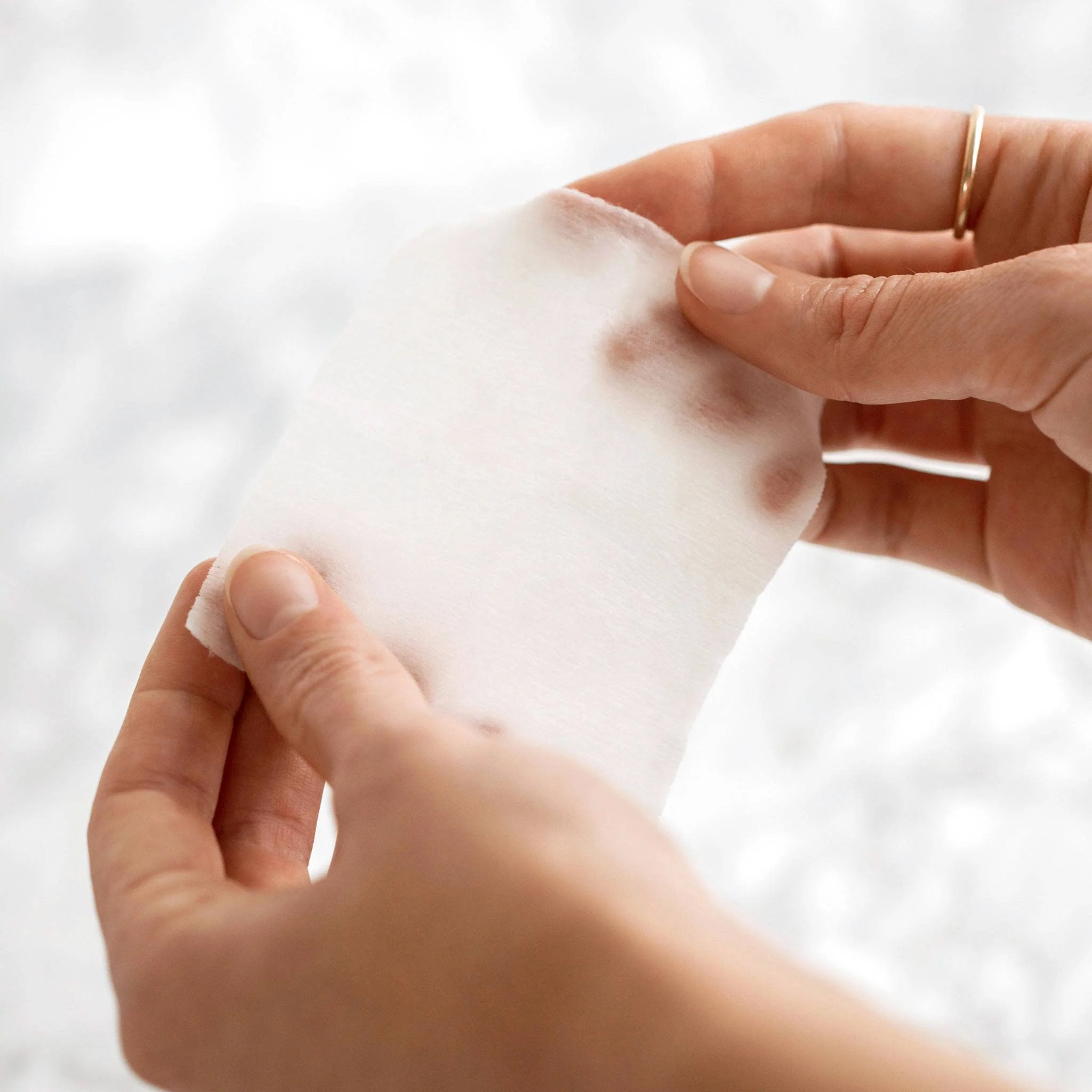 Perfect Peel - 10 Treatments - Image 8