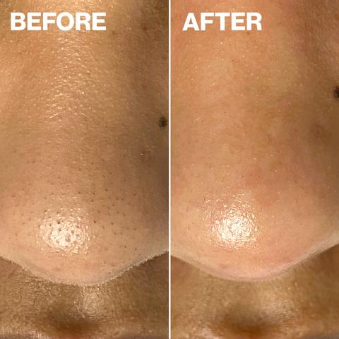 Dermapore+ Blush - Image 3