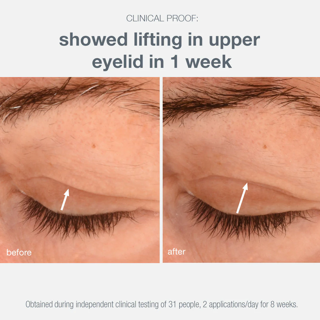 Phyto Nature Lifting Eye Cream - Image 3