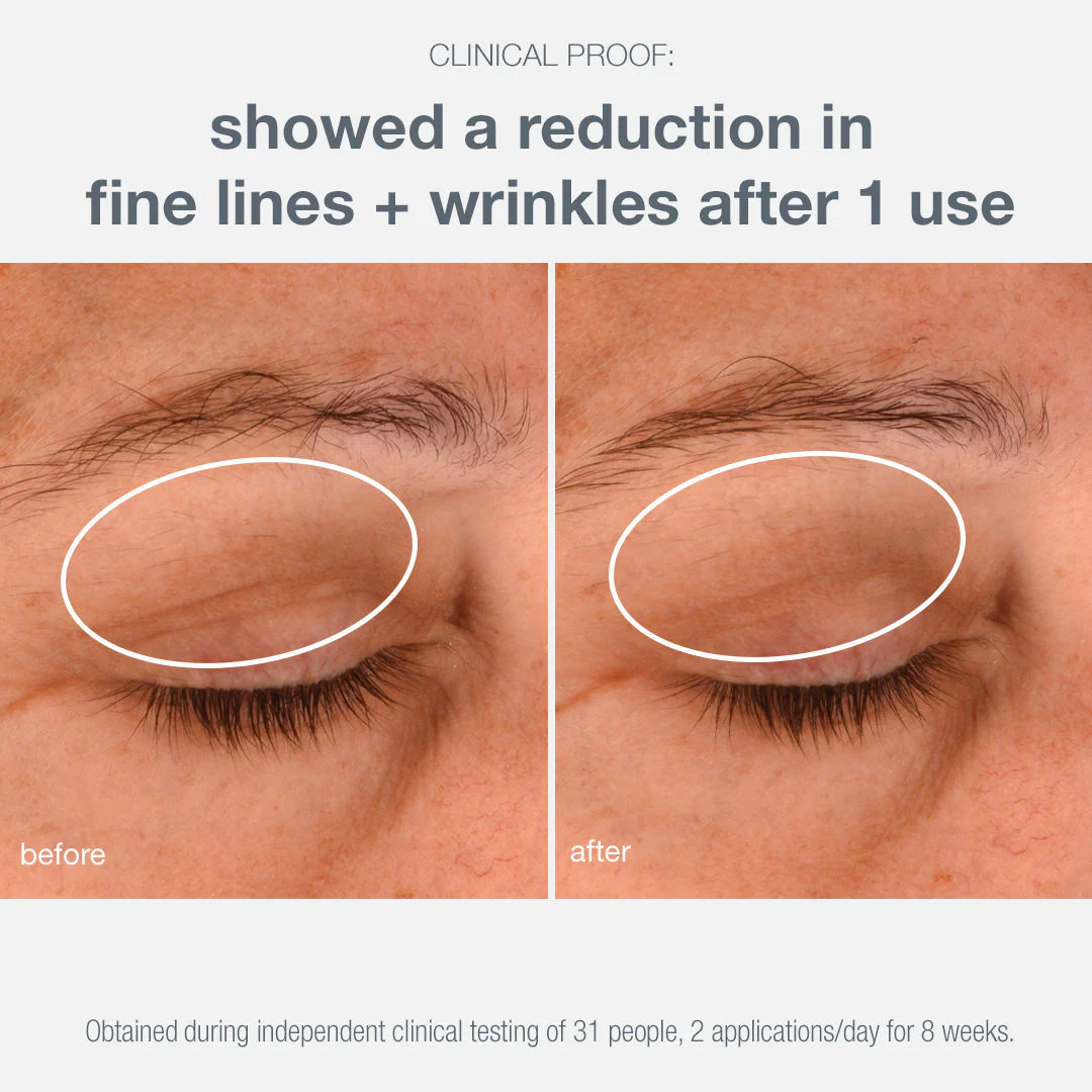 Phyto Nature Lifting Eye Cream - Image 4
