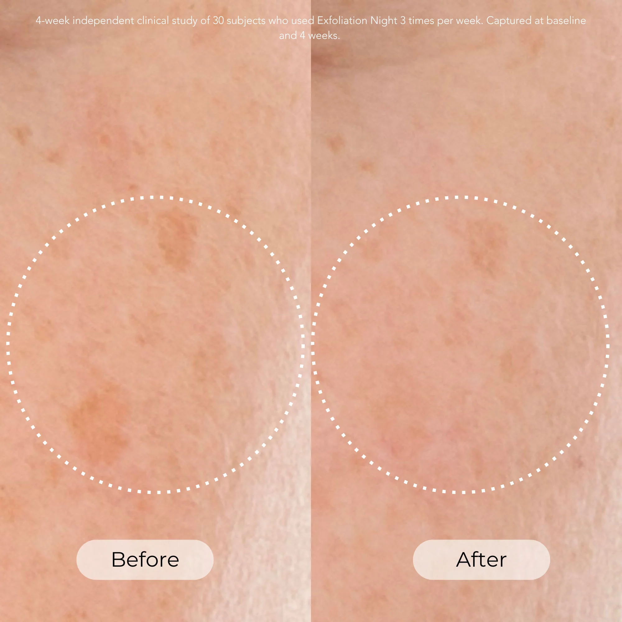 Exfoliation Night Resurfacing and Brightening Serum - Image 2