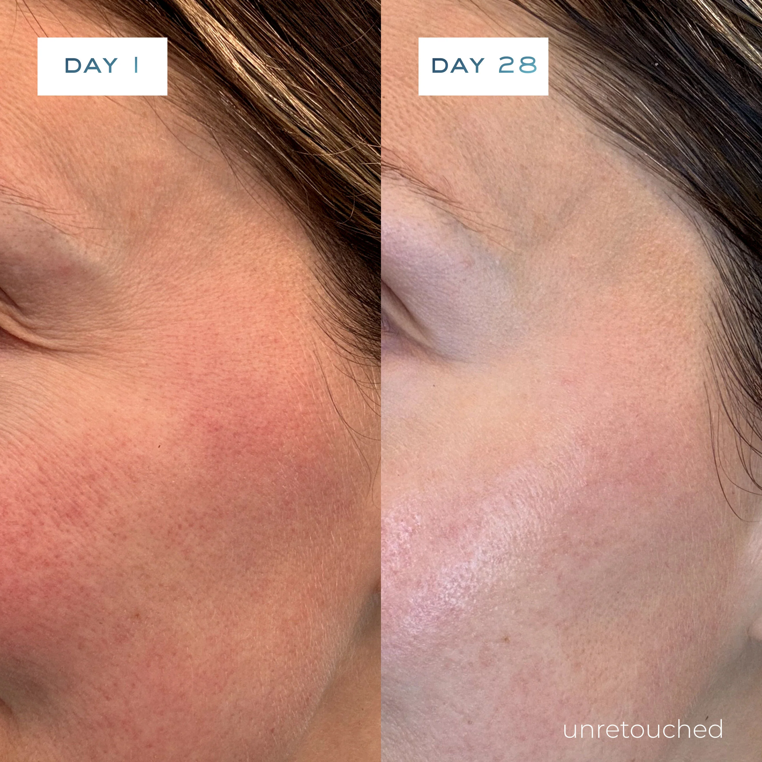 O2 Niacinamide Eight Active Serum - Image 2
