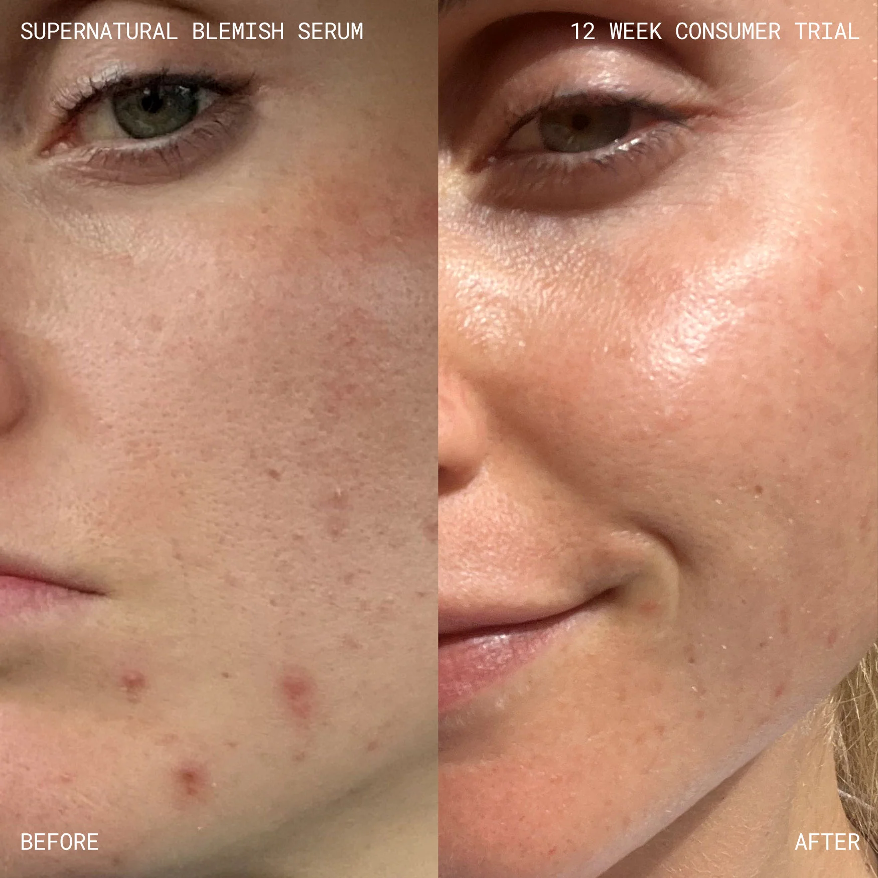 Supernatural Blemish Face Serum - Image 6