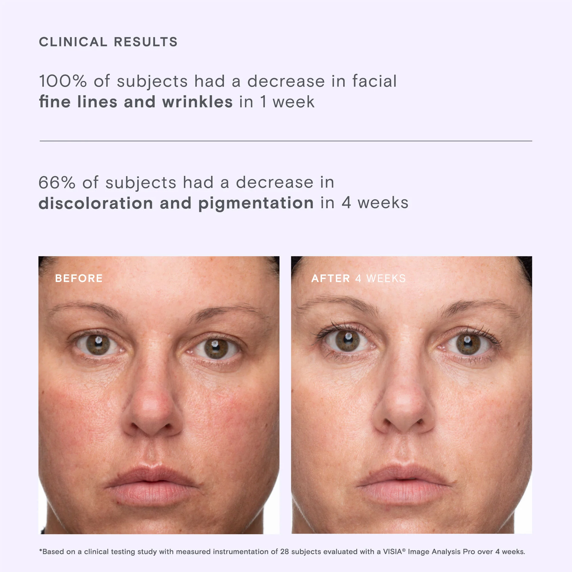 Brightening Boost Vitamin C Power Serum - Image 5