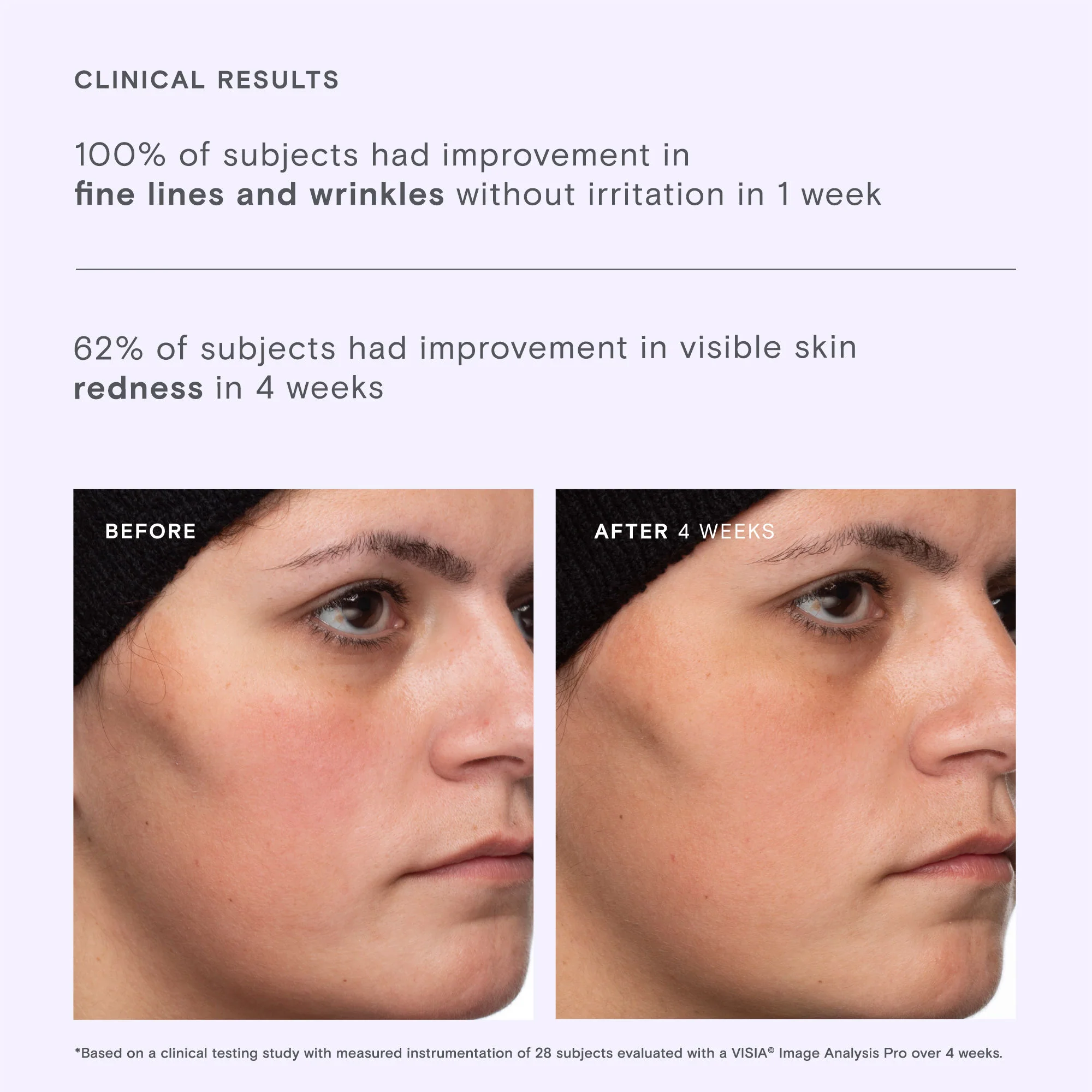 Calm Revival Green Tea Resveratrol Power Serum - Image 4