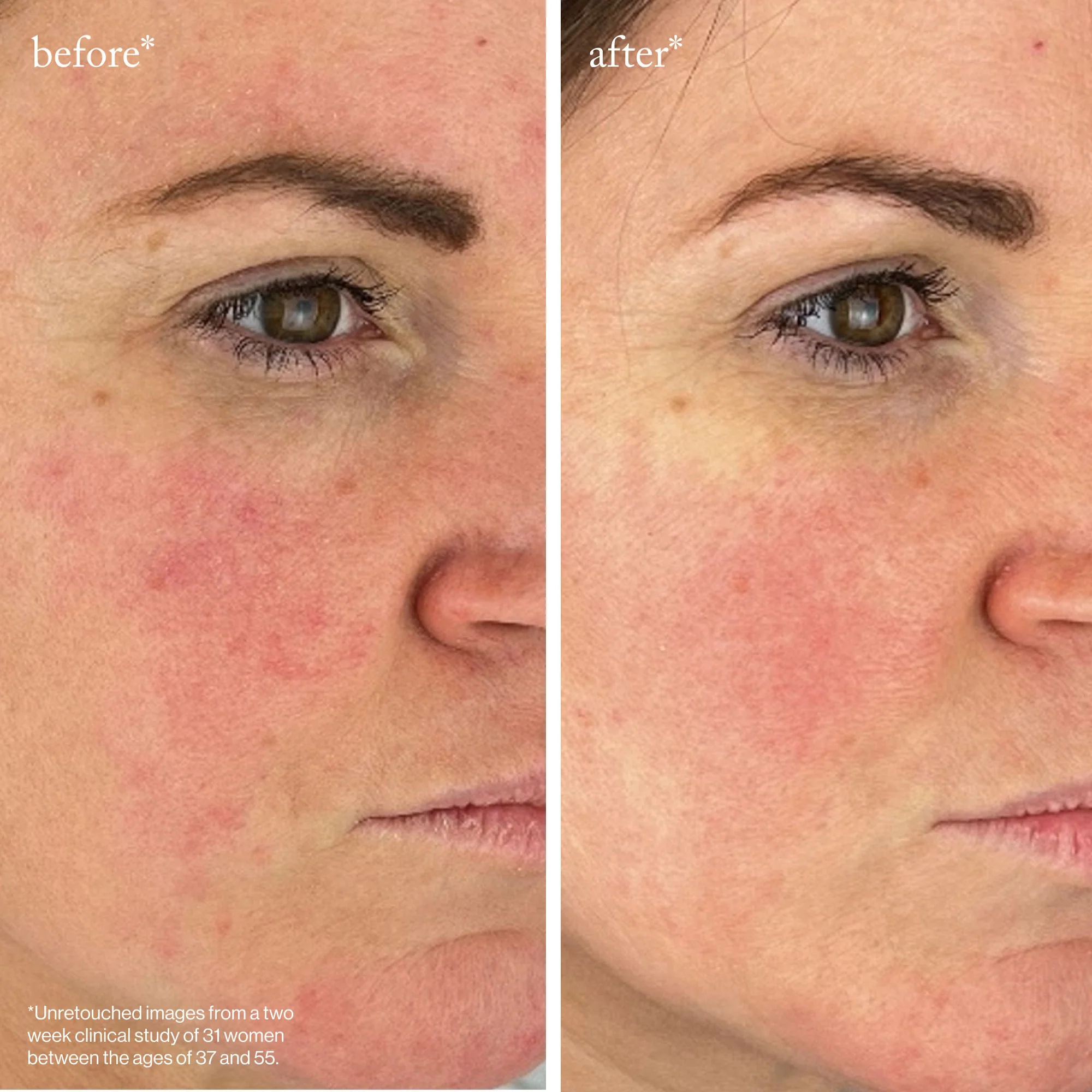 Youth-Boost Peptide Serum - Image 6