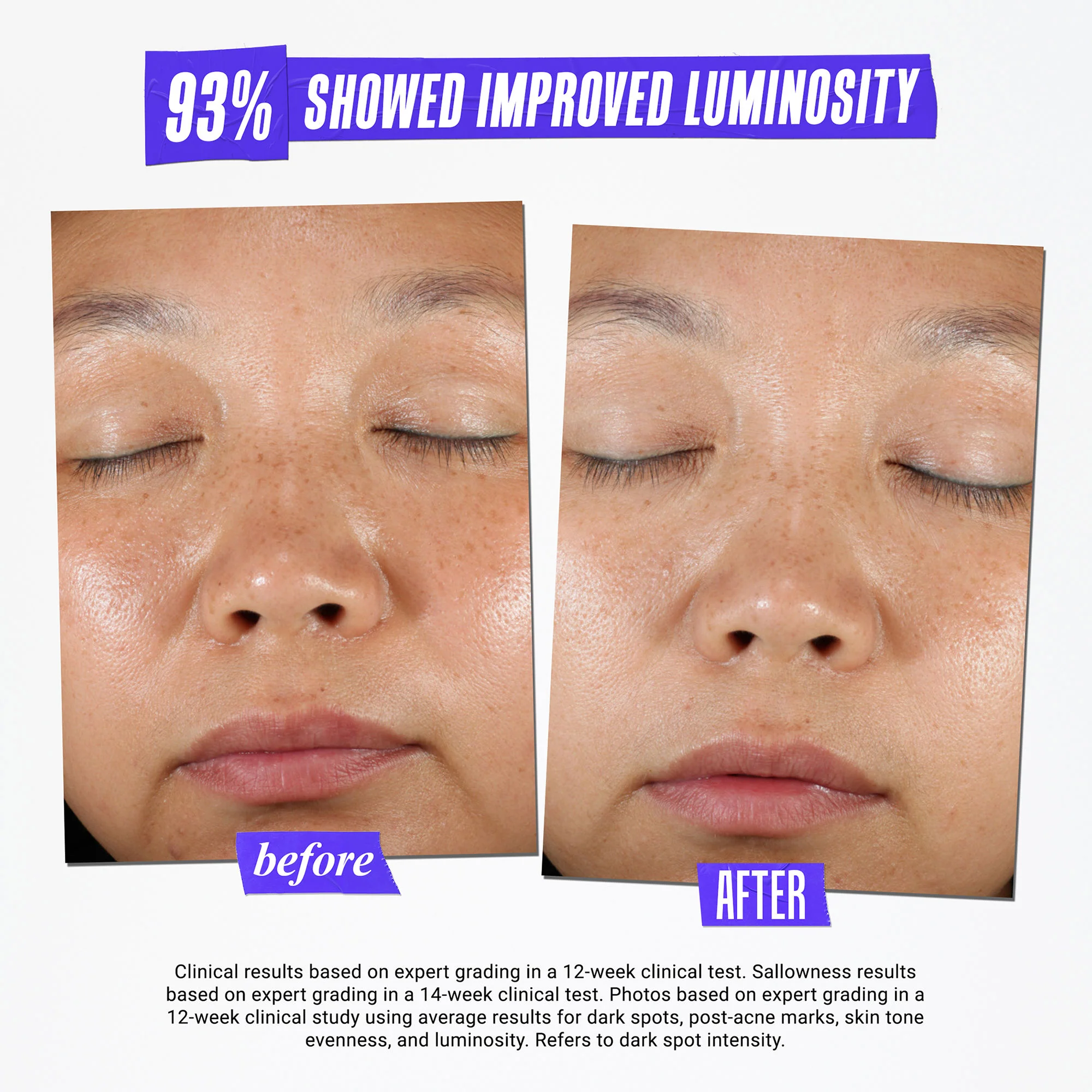 Clearly Corrective Dark Spot Solution - Image 4