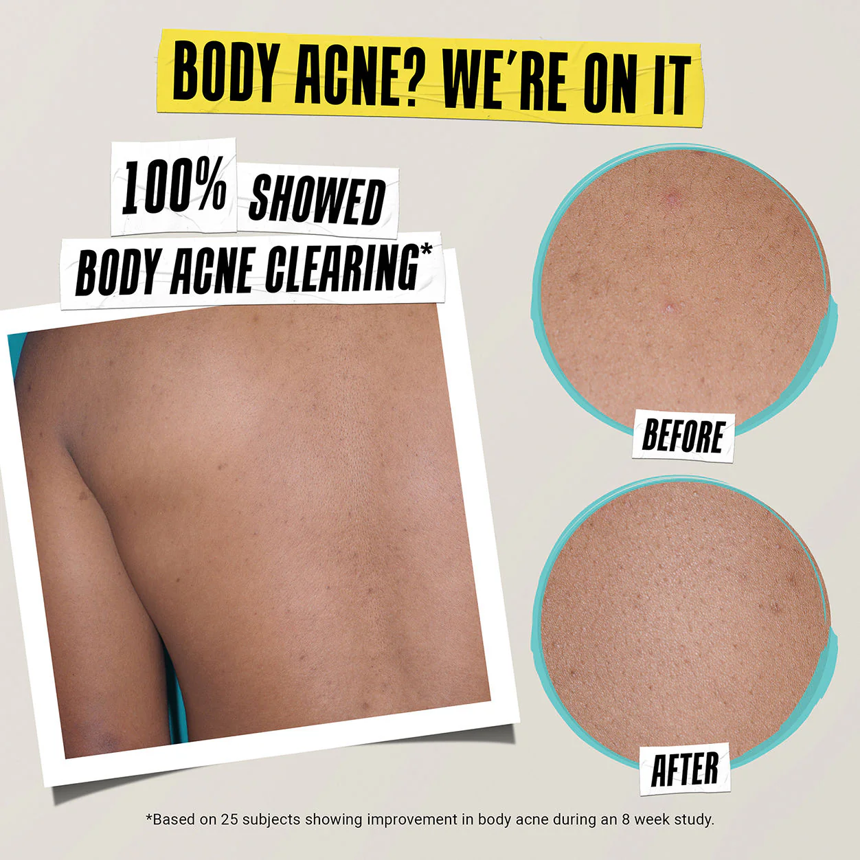 Expertly Clear Acne-Treating & Preventing Lotion - Image 5