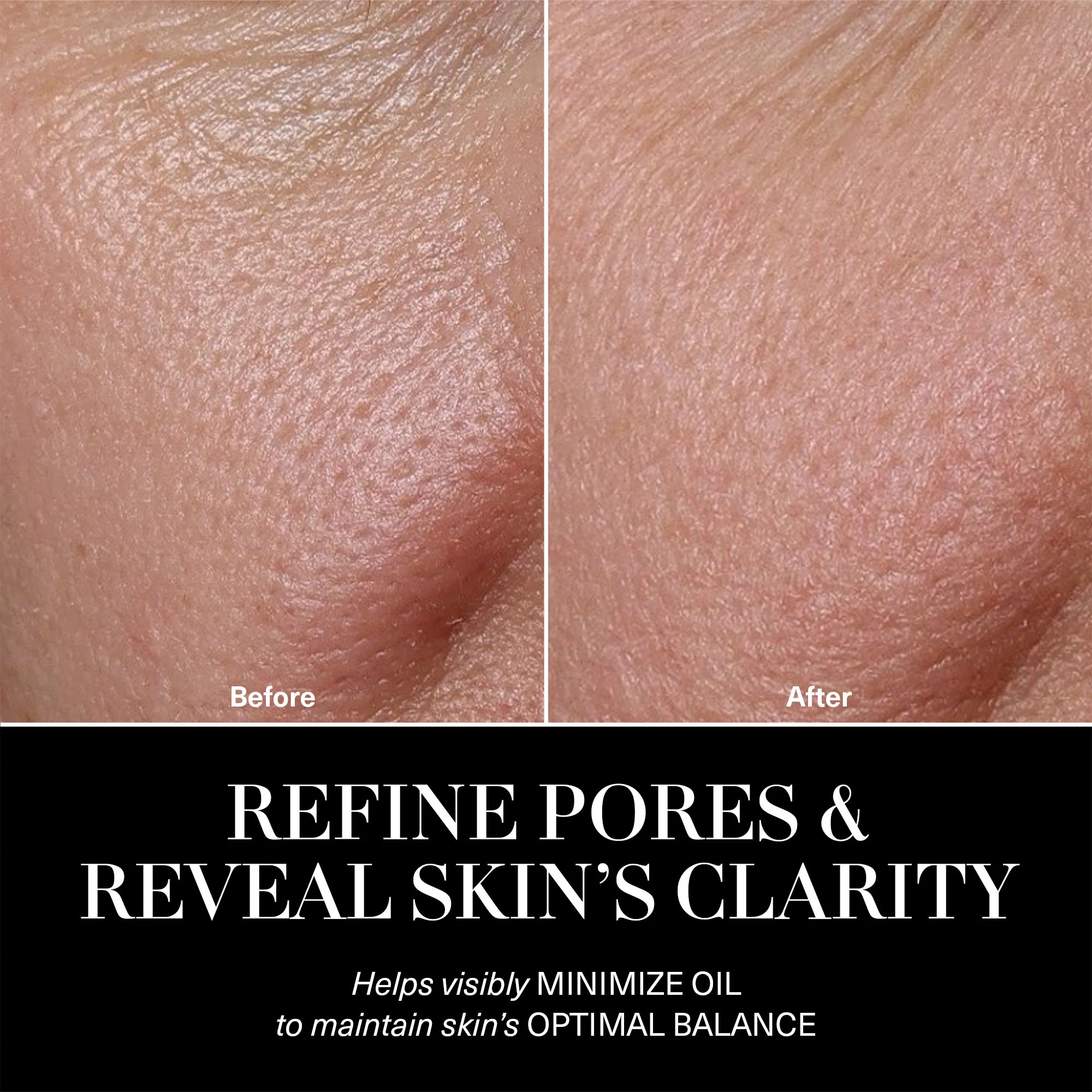 The Balancing Treatment Lotion - Image 3