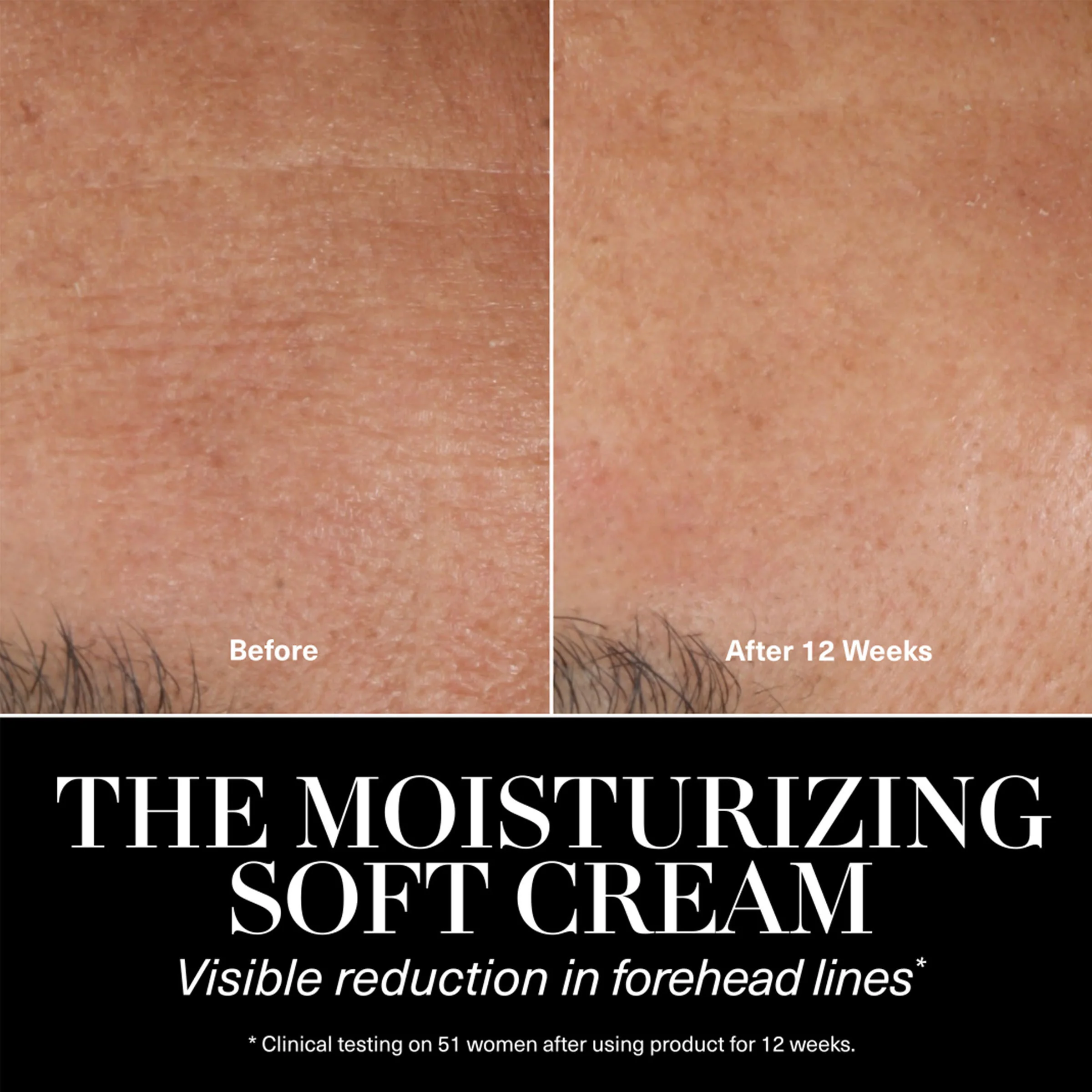 The Moisturizing Soft Cream Duet (Limited Edition) - Image 5