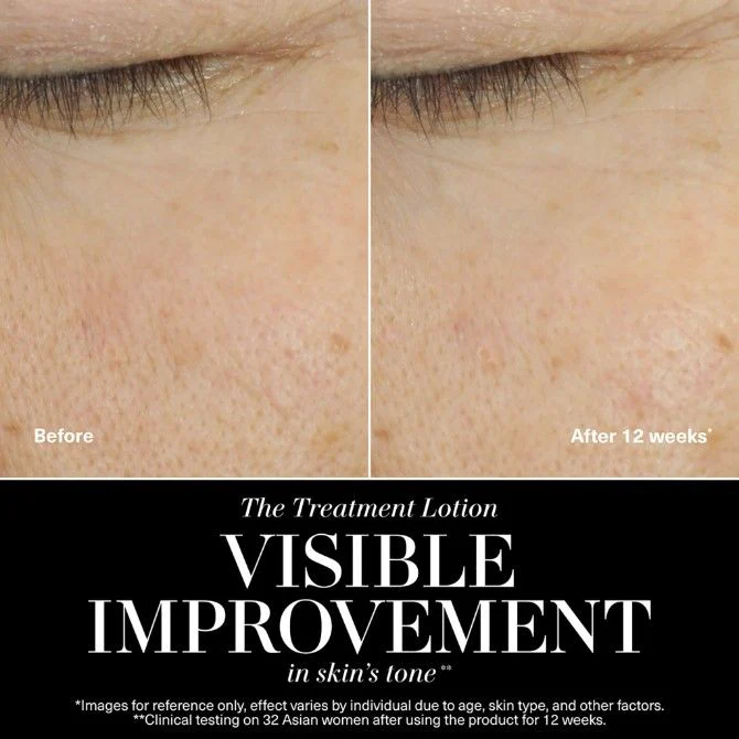The Treatment Lotion - Image 5