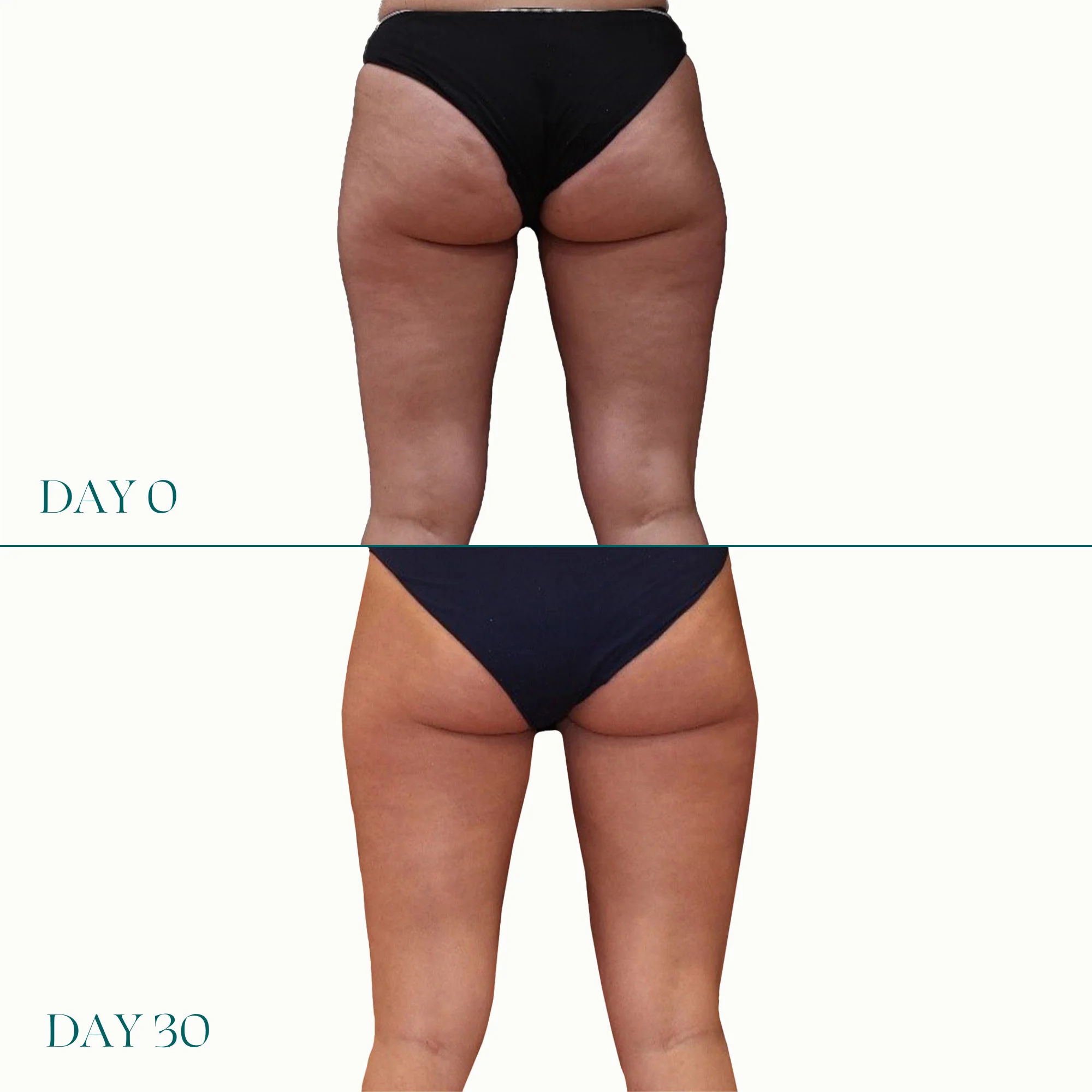 Air-Lite Daily Lift For Legs - Image 11