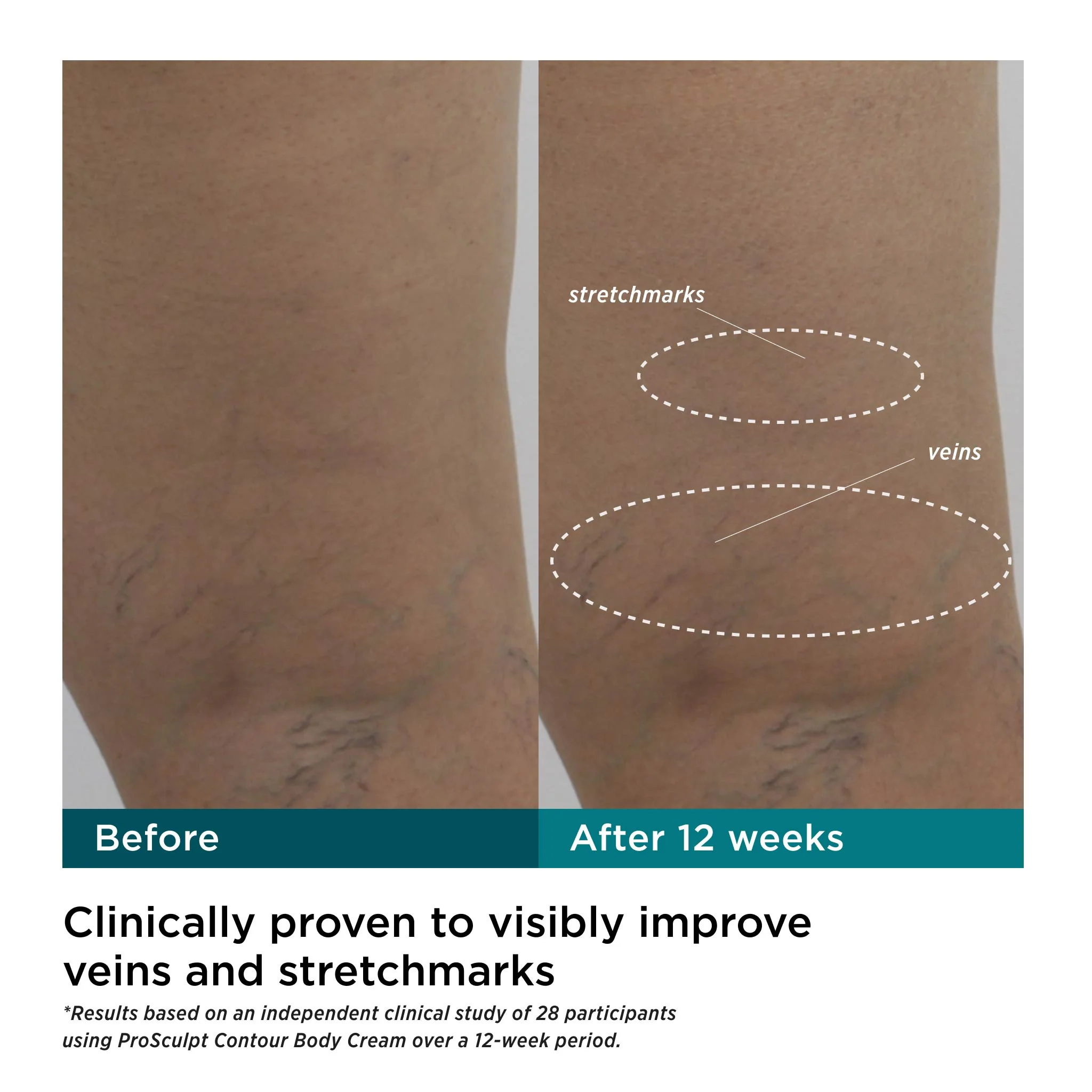 ProSculpt Contour Body Cream with AFT3™ - Image 4