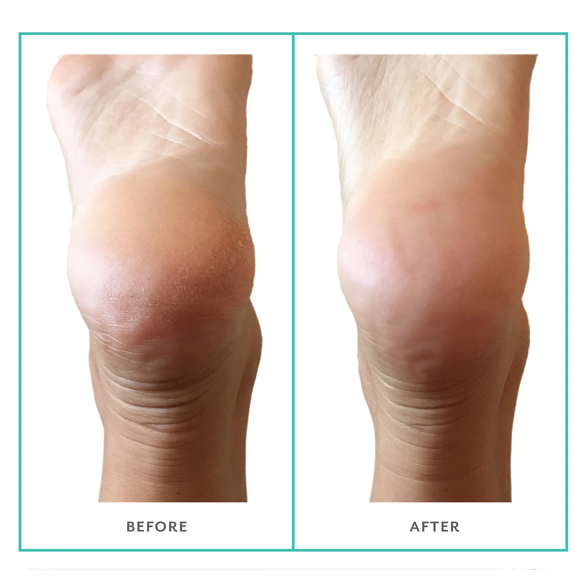PoshPeel Pedi Cure - Image 5