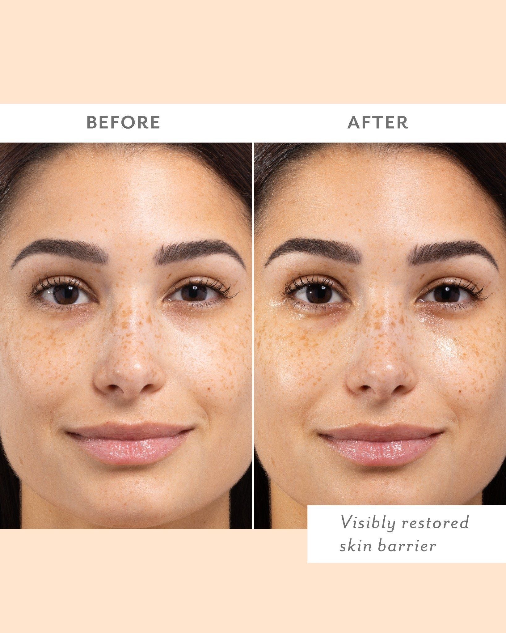Skin Remedy Barrier-Boosting Sheet Mask - Image 2