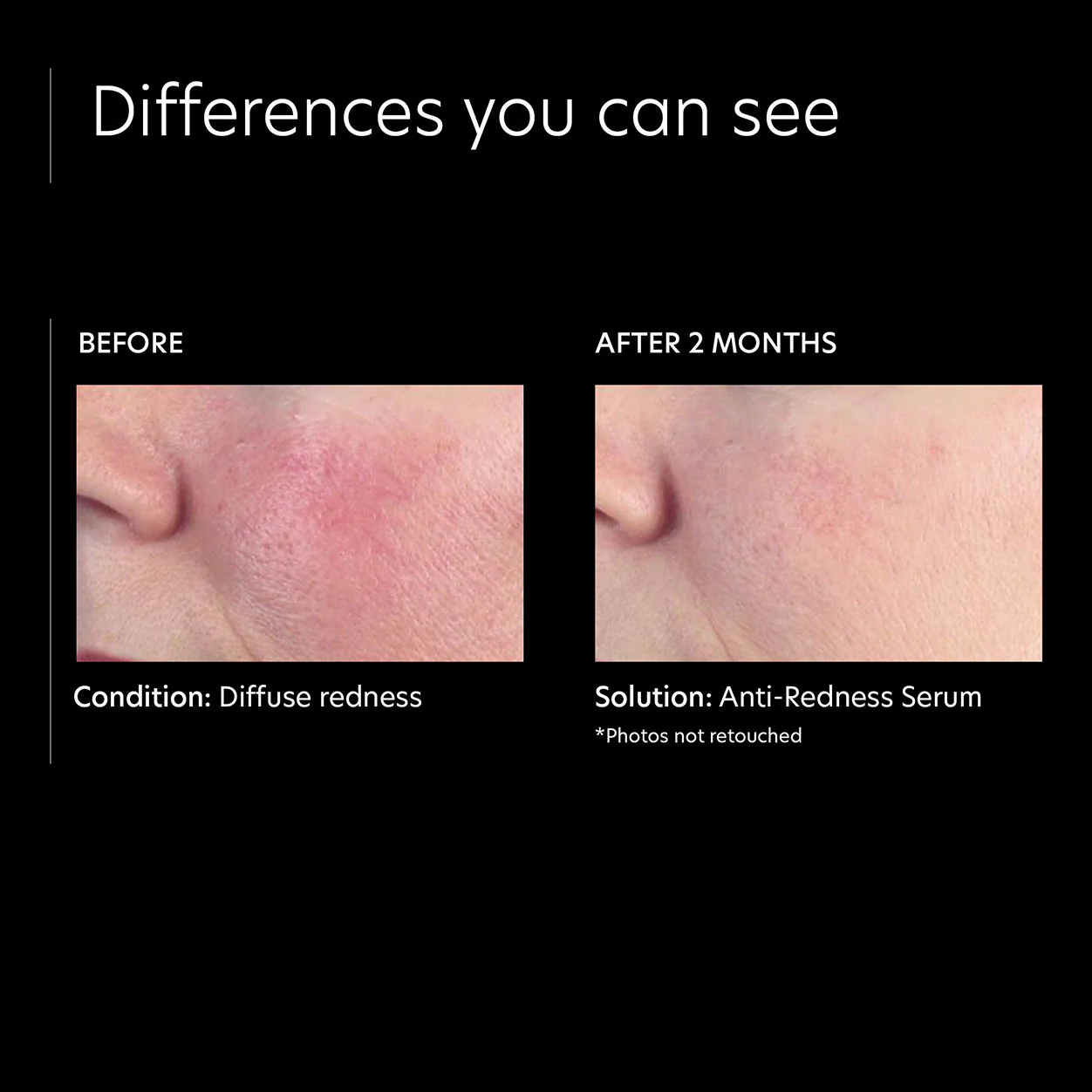 Anti-Redness Serum - Image 3