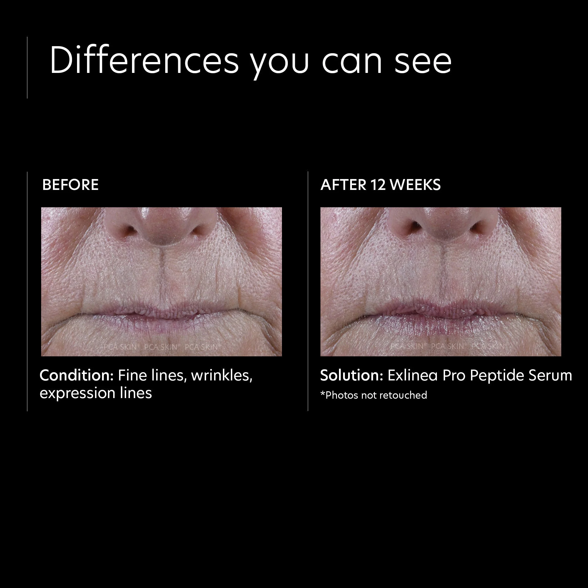 ExLinea Pro Peptide Serum - Image 3