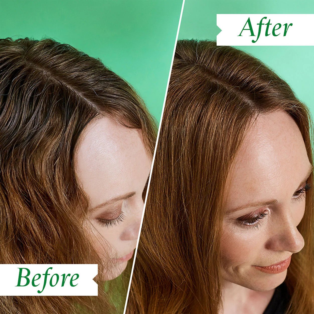Flaky Scalp Soothing Dry Shampoo - Image 2