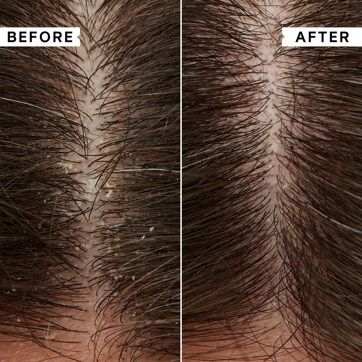Flaky Scalp Hydrating Conditioner - Image 2
