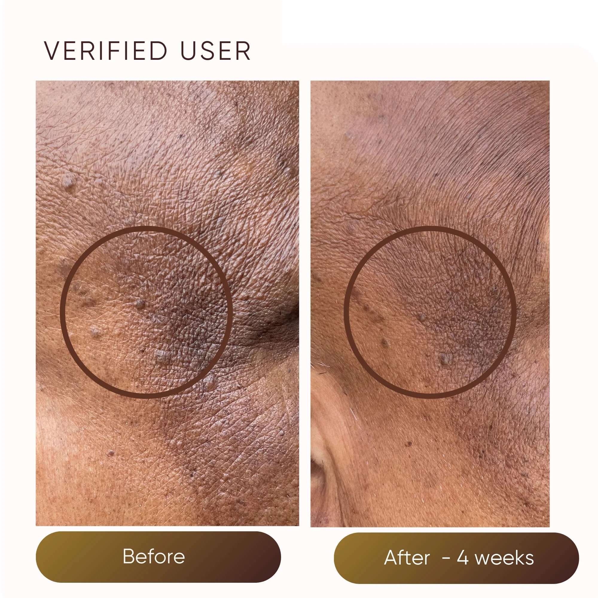 Hydrating Moisturizer - Image 3