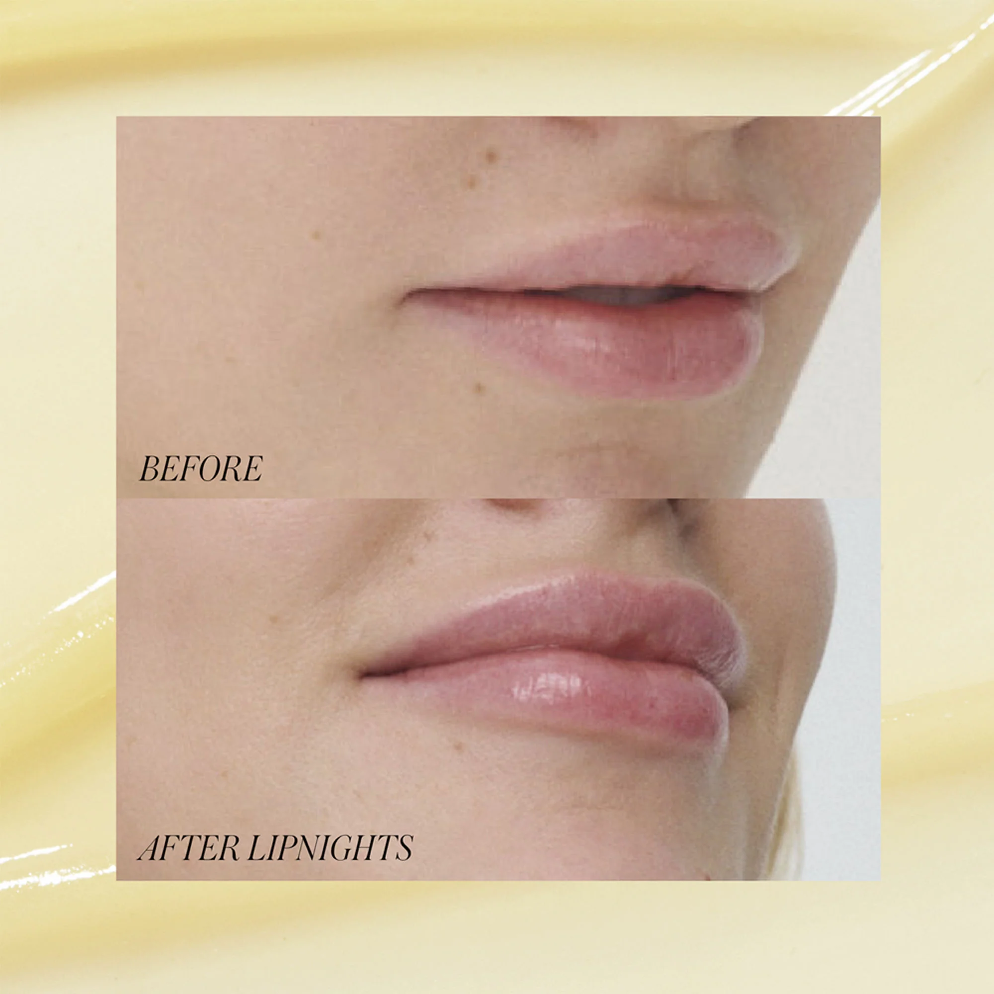 Lipnights Overnight Lip Mask - Image 3