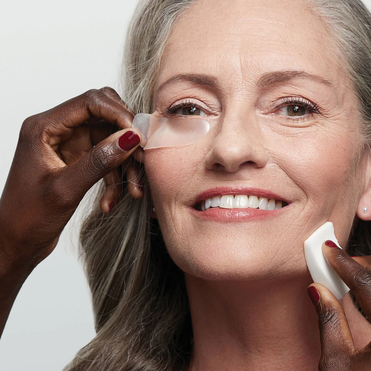 Eye and Smile Lift - Image 3