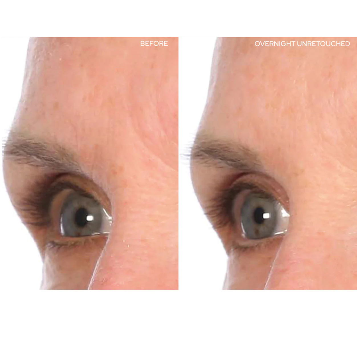 Mid-BrowLift 11s - Image 2