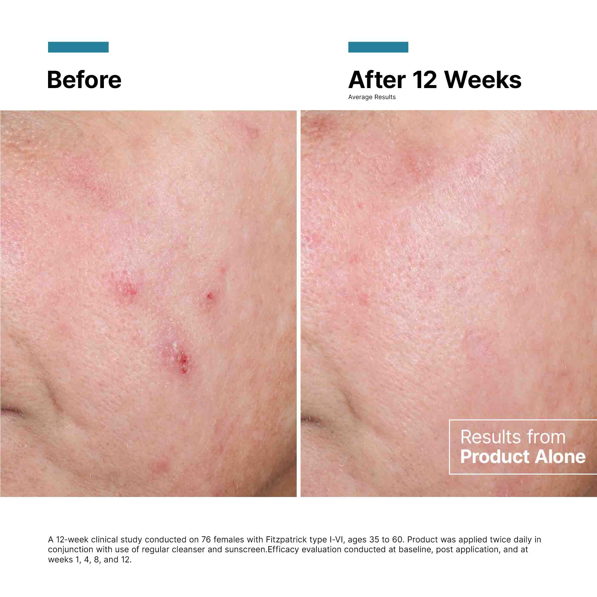 Advanced RGN-6 Regenerative Cream - Image 6
