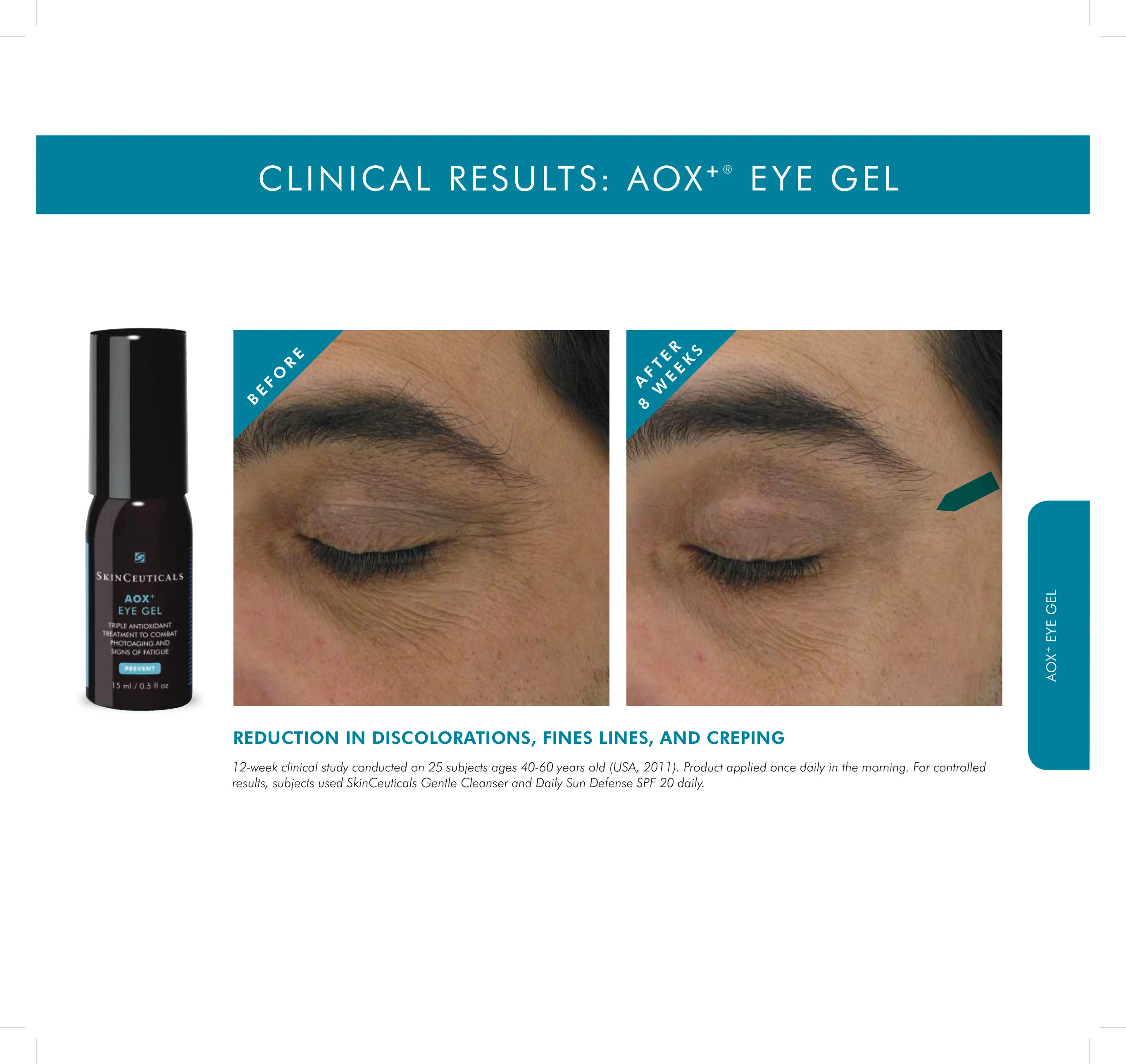 Aox+ Eye Gel - Image 3