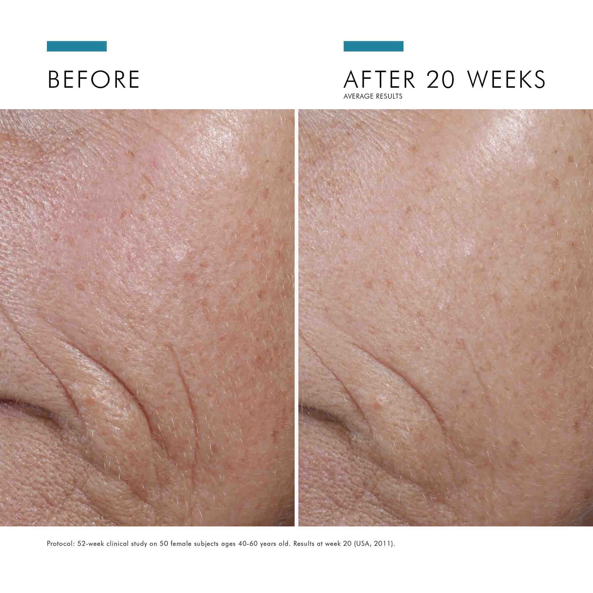C E Ferulic - Image 4