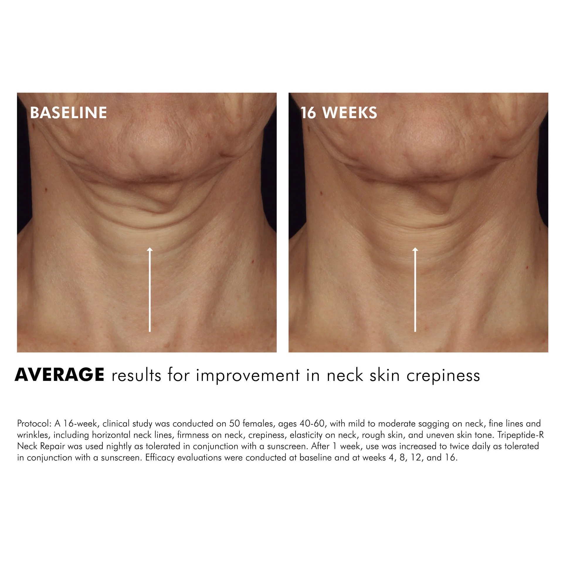 Tripeptide-R Neck Repair - Image 3