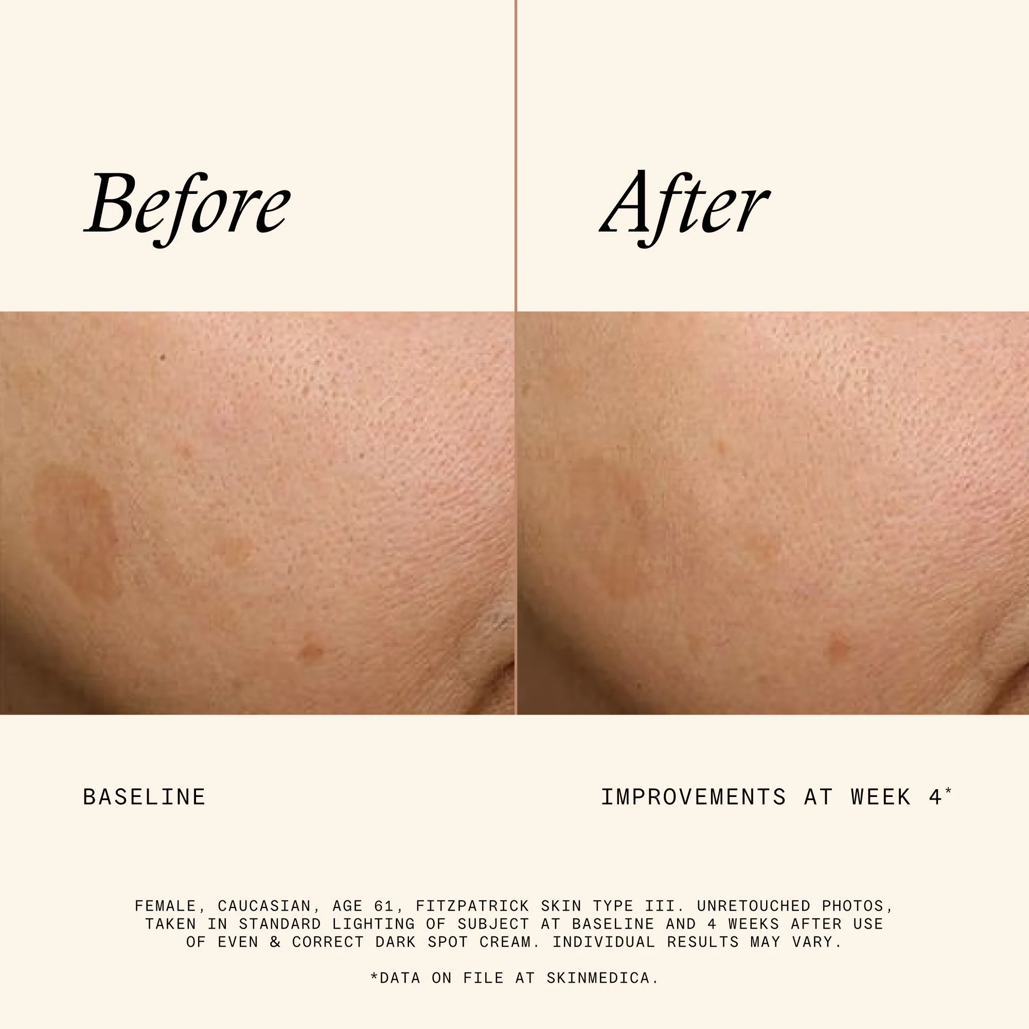 Even & Correct Dark Spot Cream - Image 5