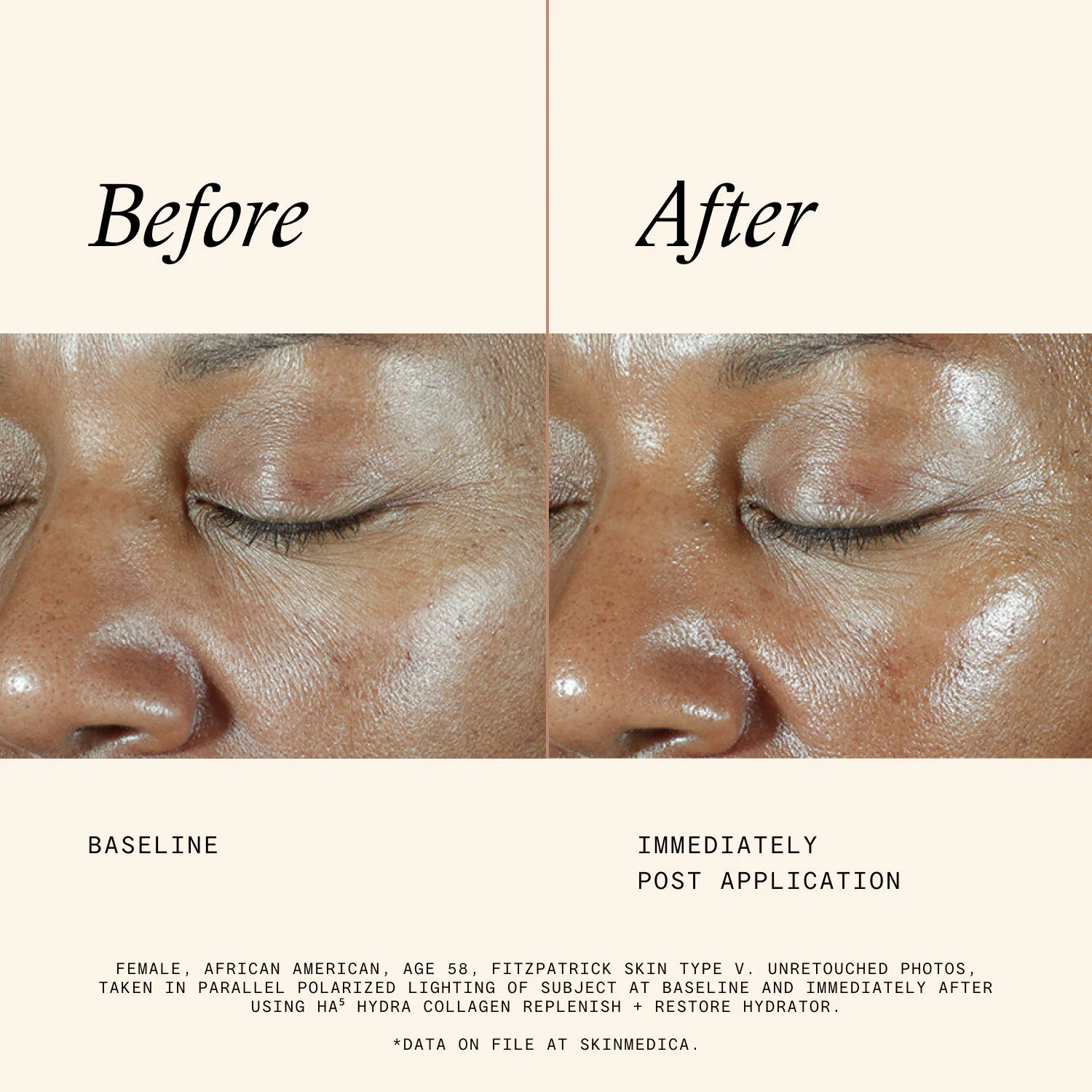 HA⁵ Hydra Collagen Hydrator with Vegan Collagen - Image 6