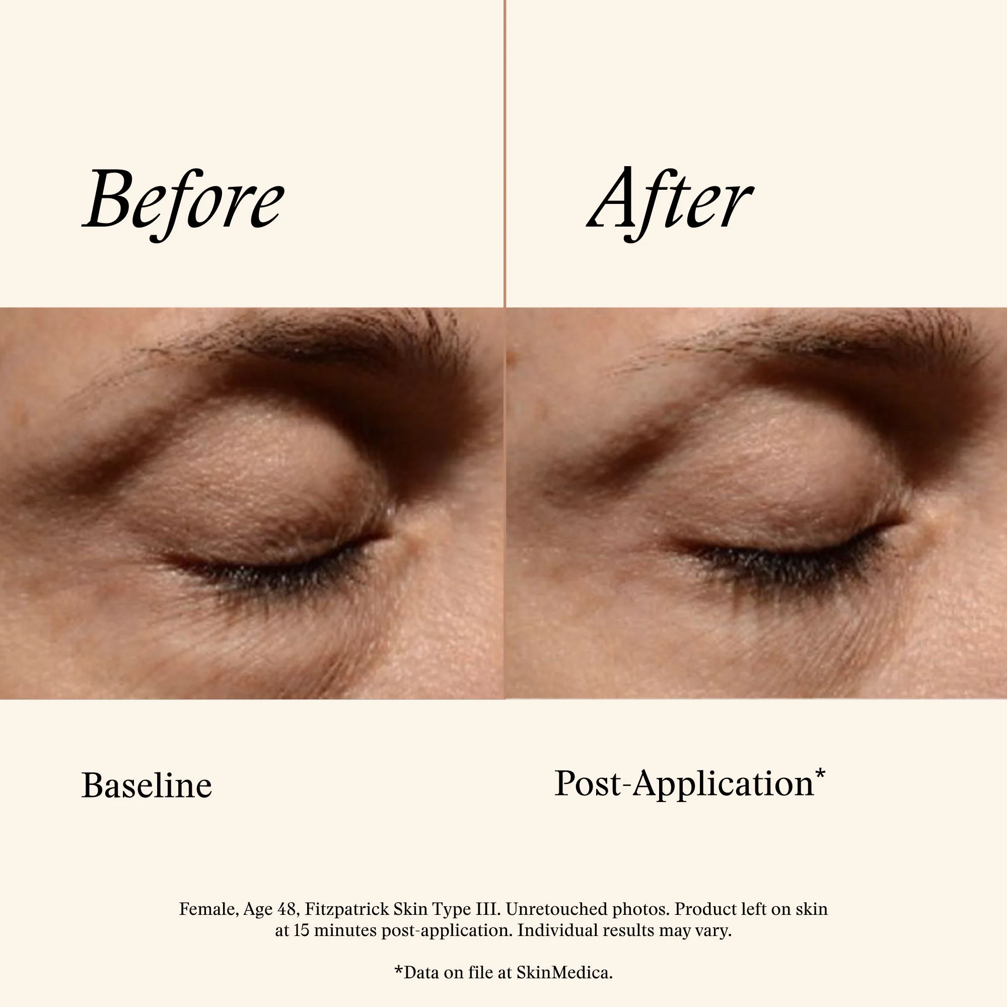 Instant Bright Eye Cream - Image 6