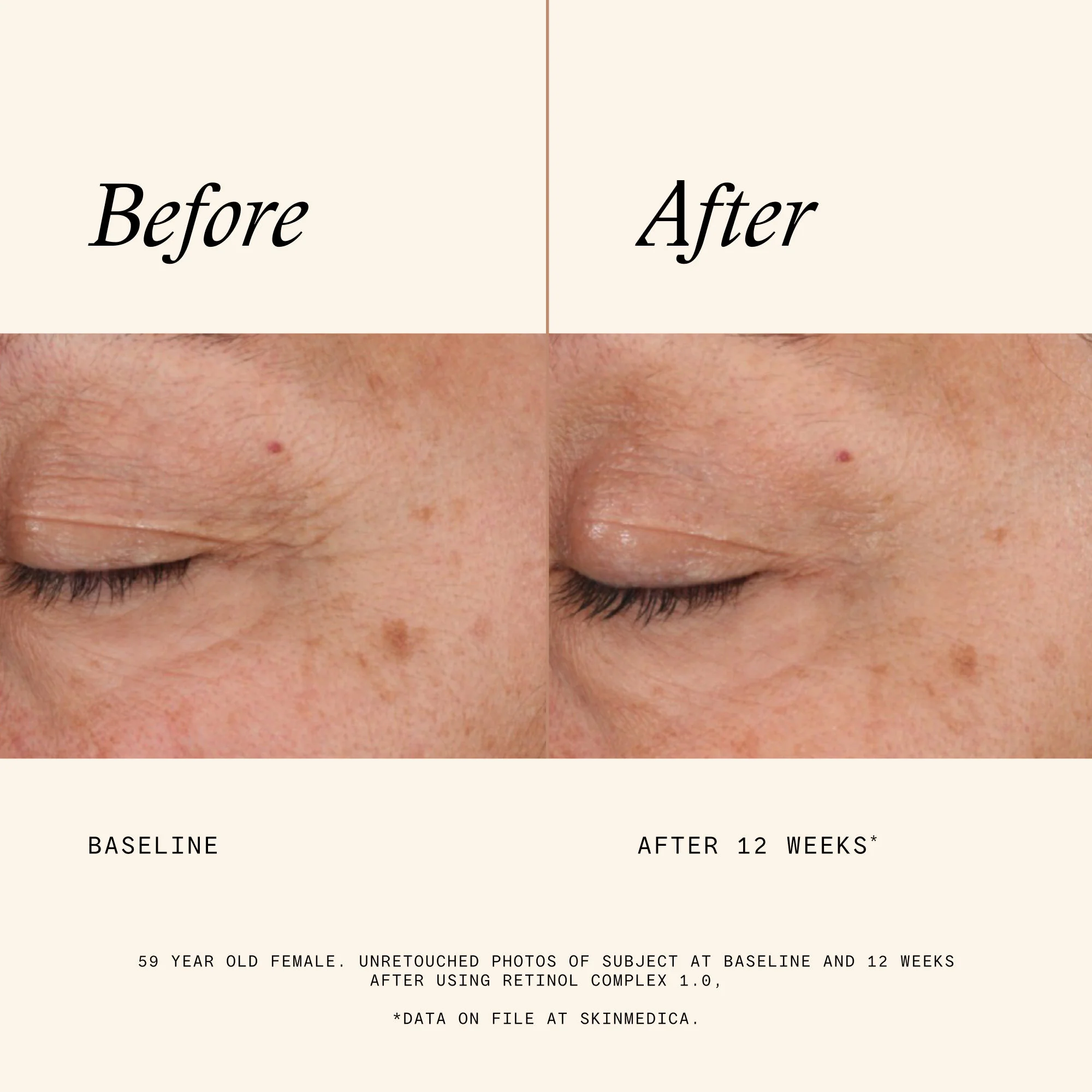 Retinol Complex 1.0 - Image 6