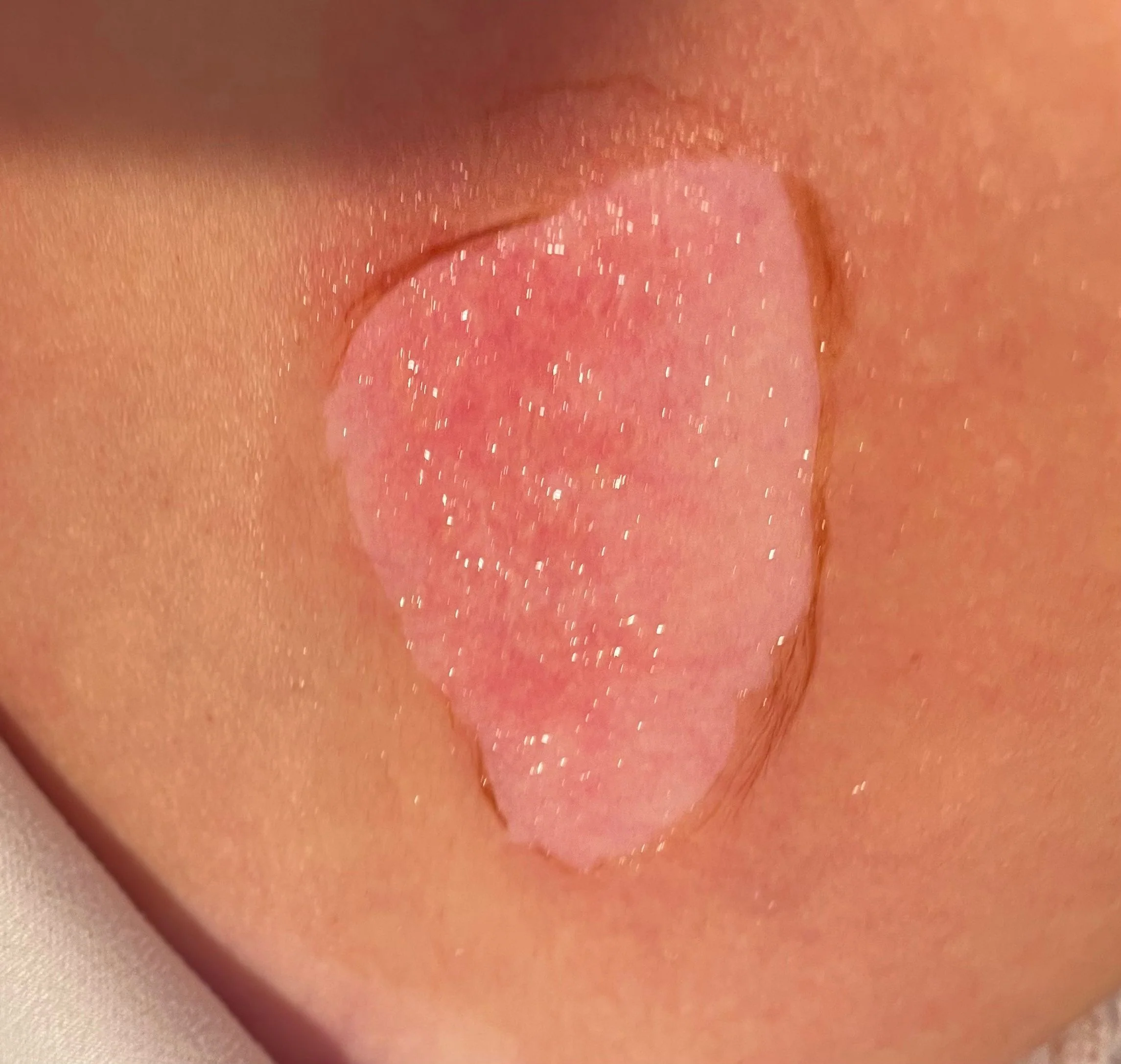 Scar Concentrate - Image 3