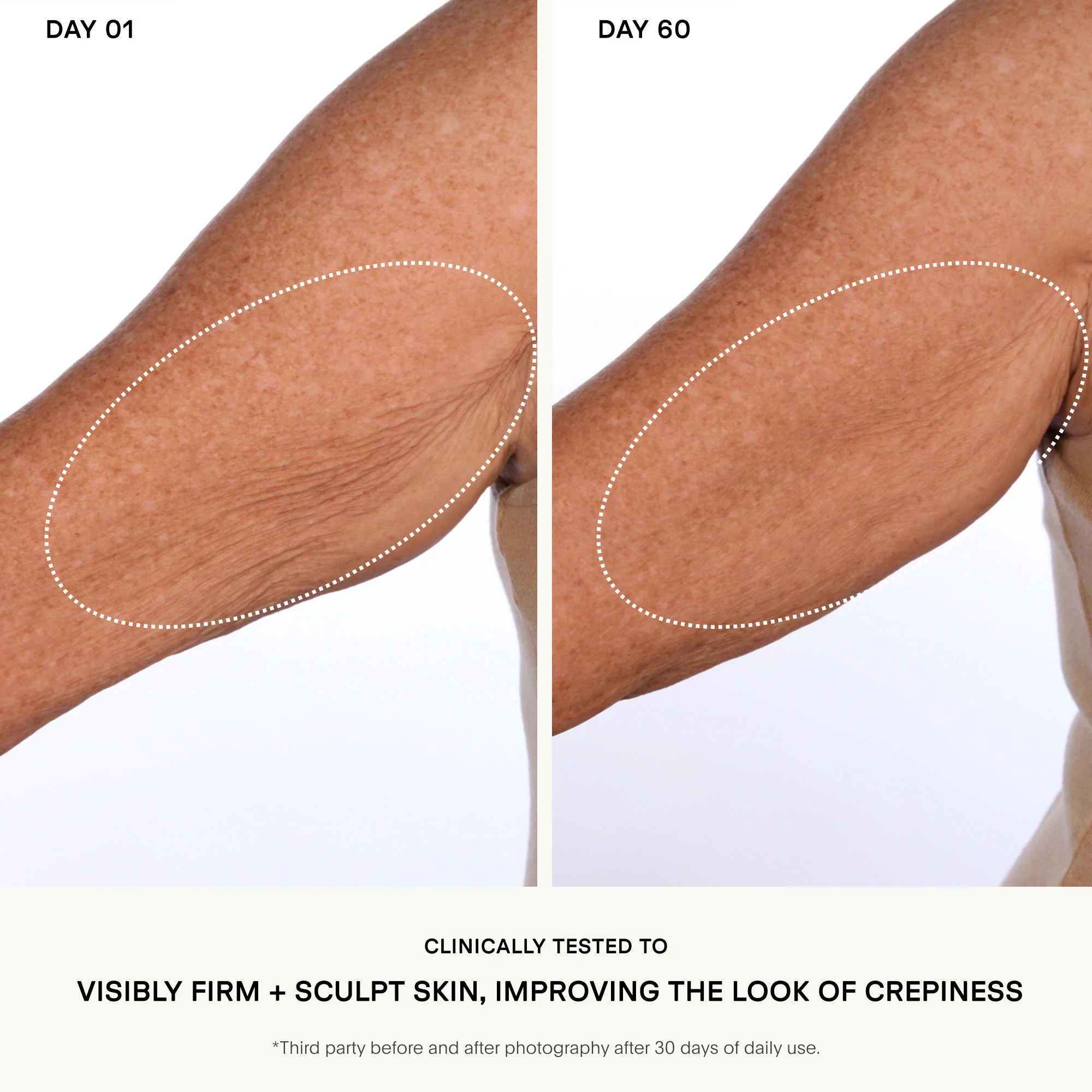 The Sculpt Arm Compound - Image 3