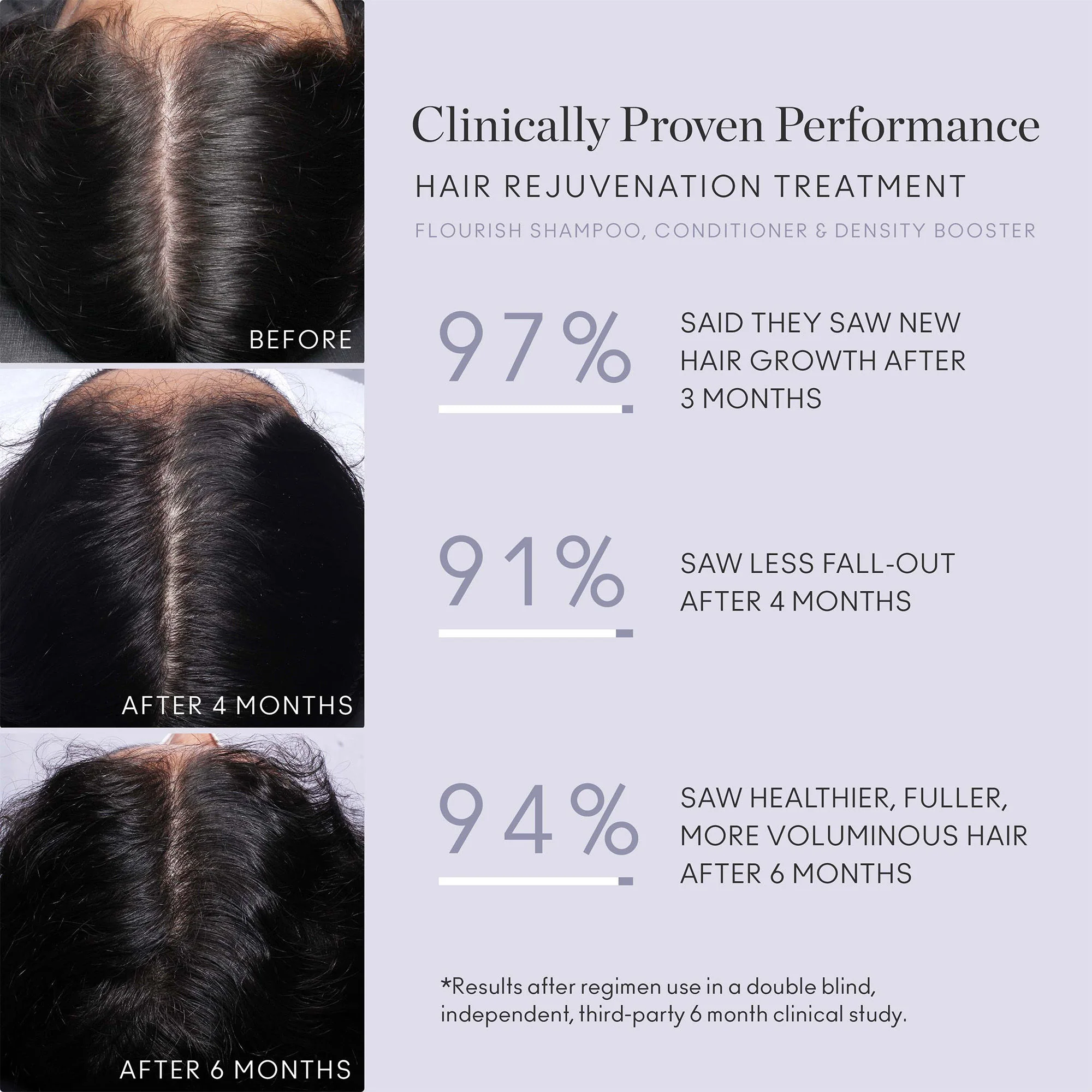Flourish Nightly Intensive Hair Rejuvenation Treatment 30 Day - Image 4